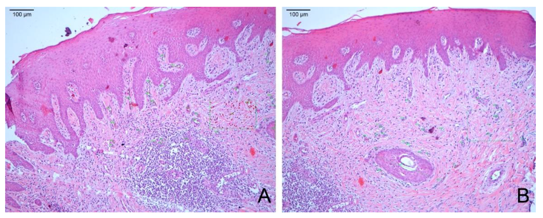 Materials 14 00272 g008