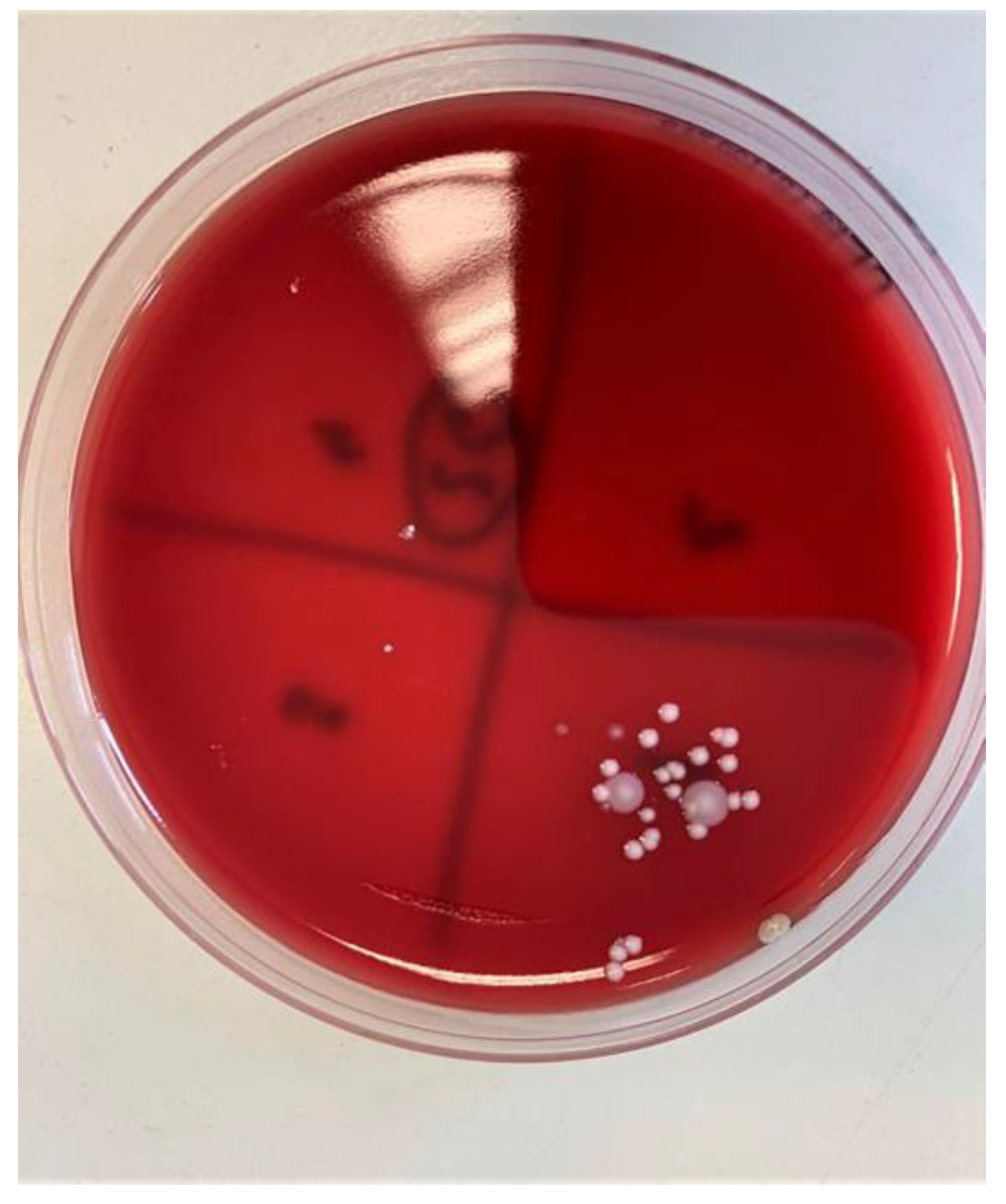 Materials 14 00385 g011