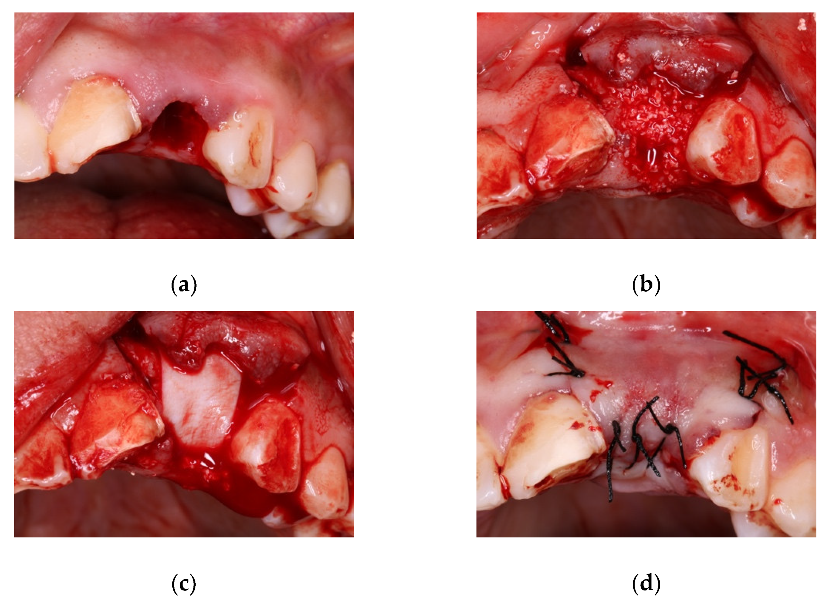 Materials 14 00940 g001 Materials 14 00940 g001