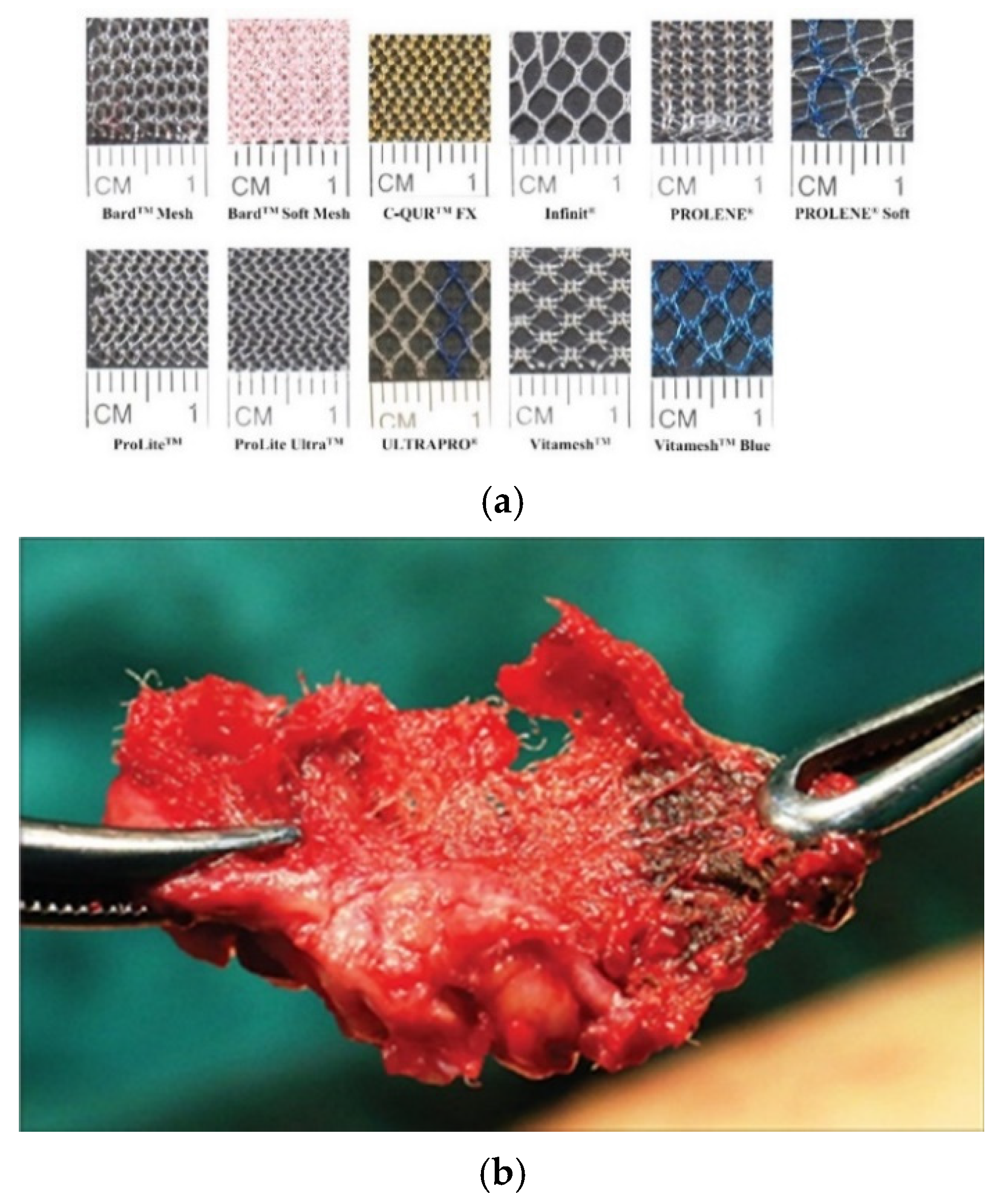 Materials 14 00941 g001 Materials 14 00941 g001