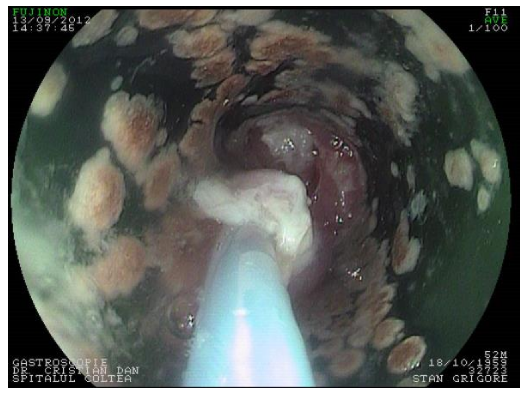 Materials 14 01436 g007