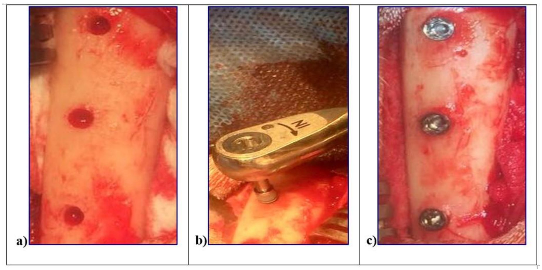 Materials 14 01830 g001 Materials 14 01830 g001