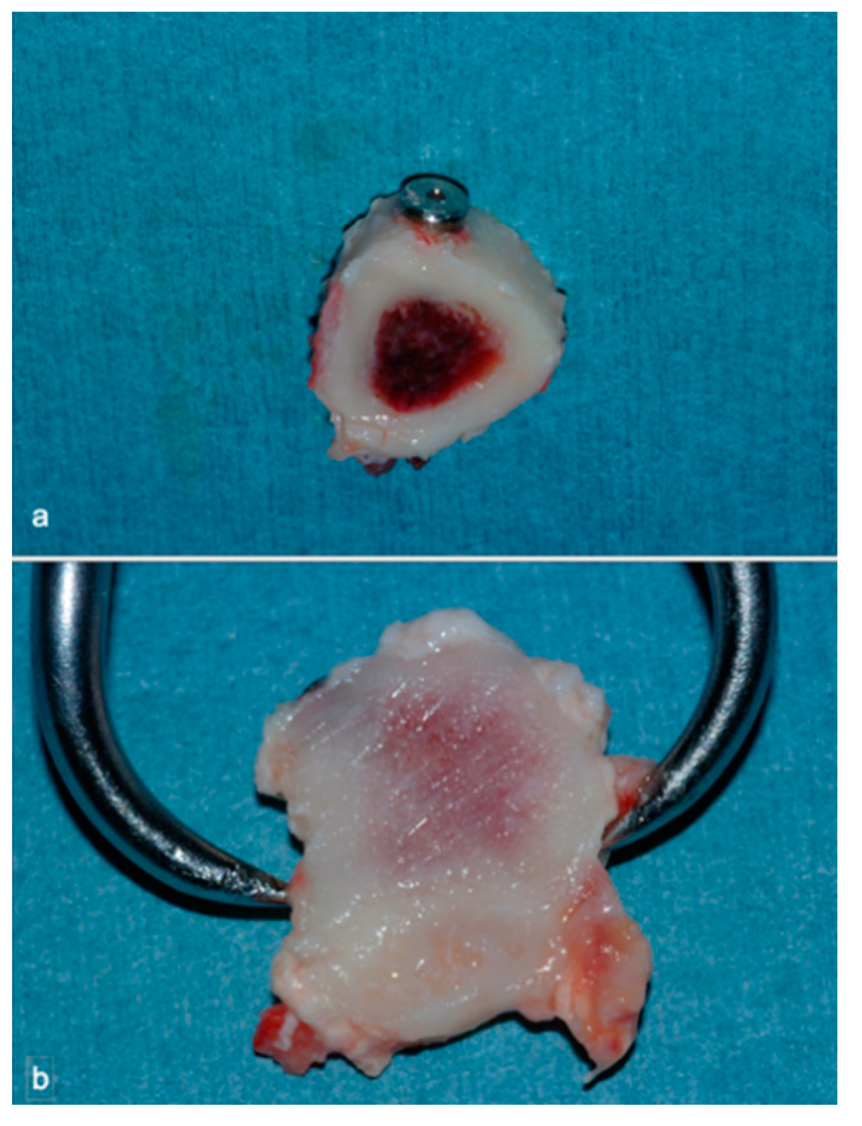 Materials 14 02185 g005 Materials 14 02185 g005