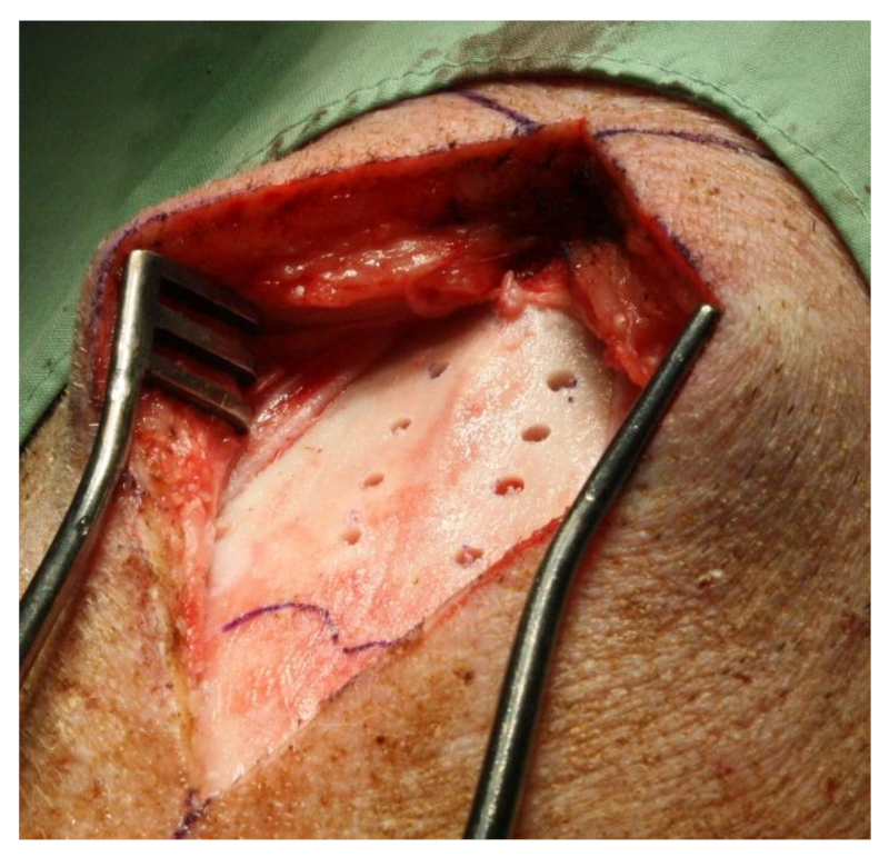 Materials 14 02645 g002