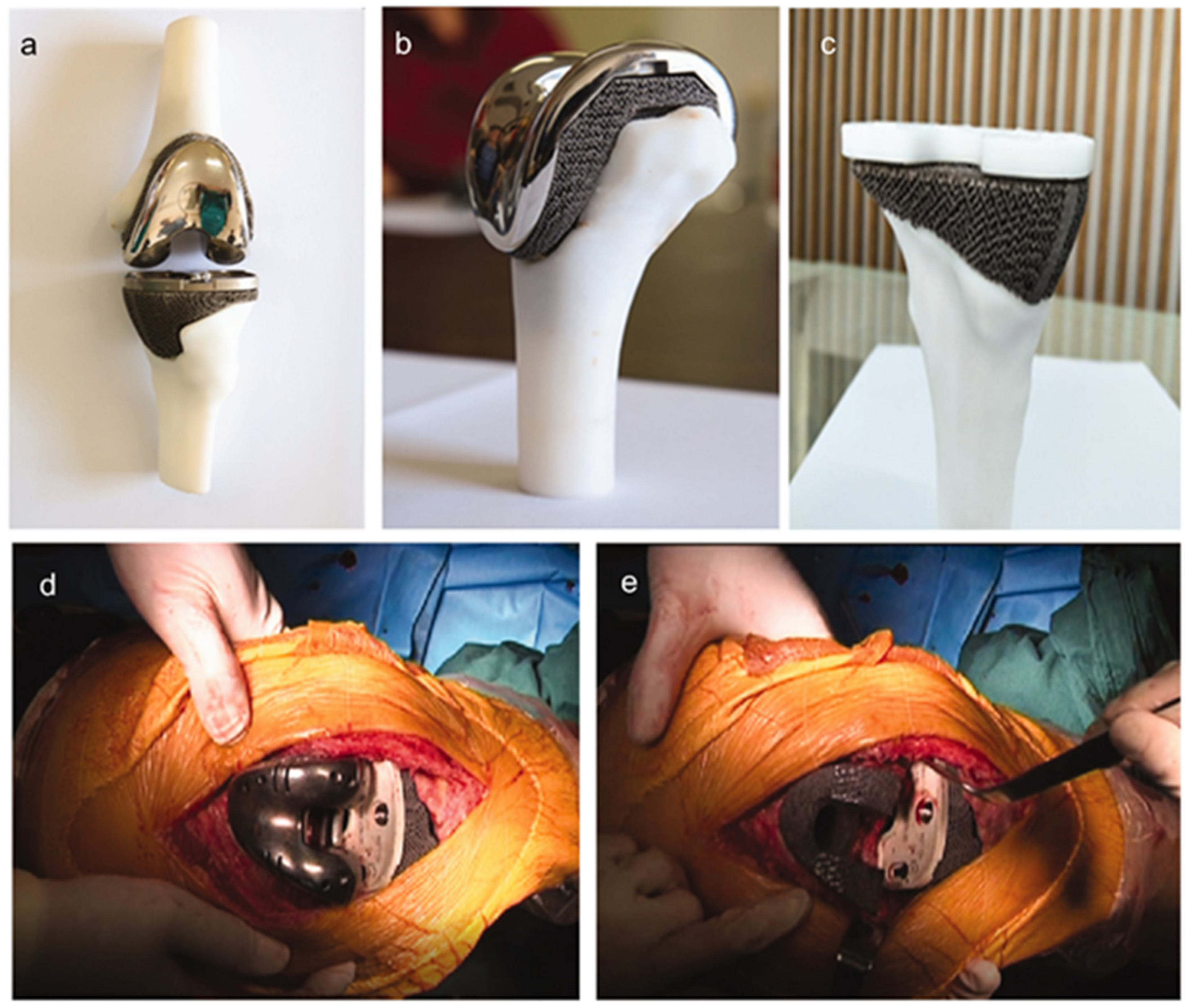 Materials 14 02647 g005