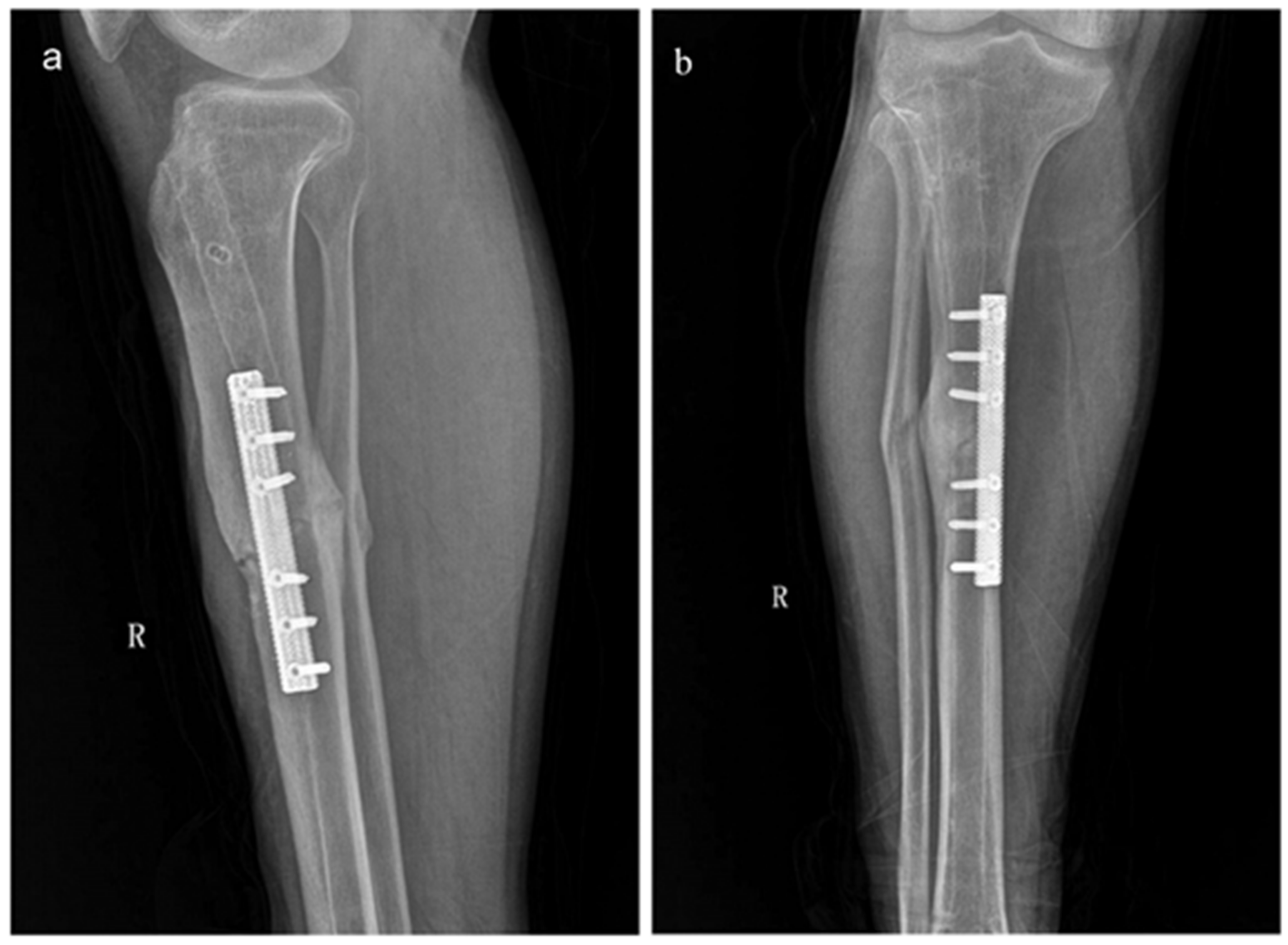 Materials 14 02647 g006