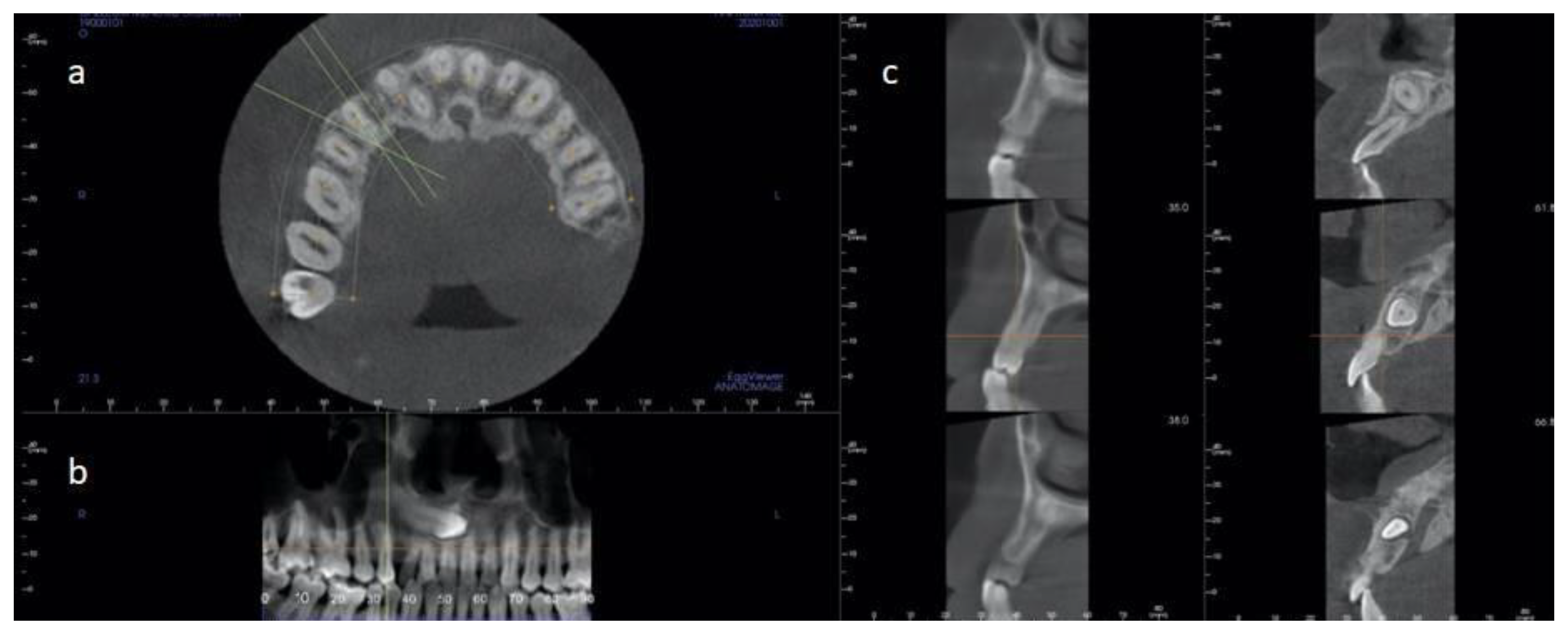 Materials 14 02757 g002