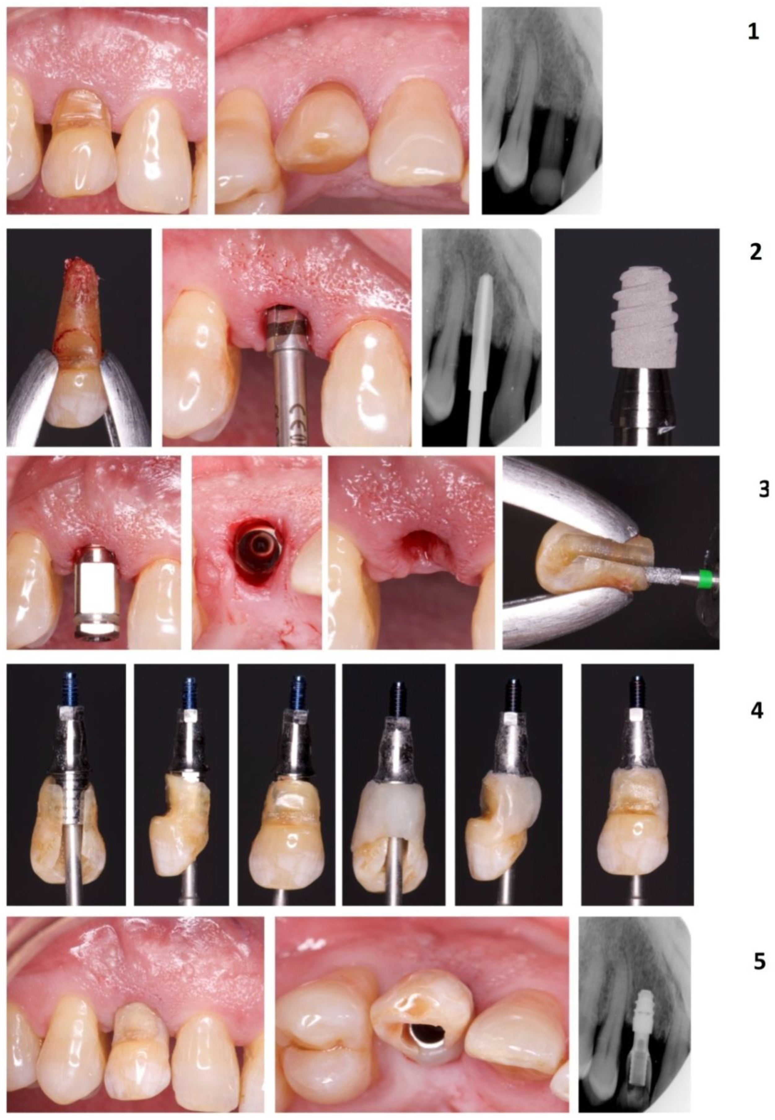Materials 14 02757 g003