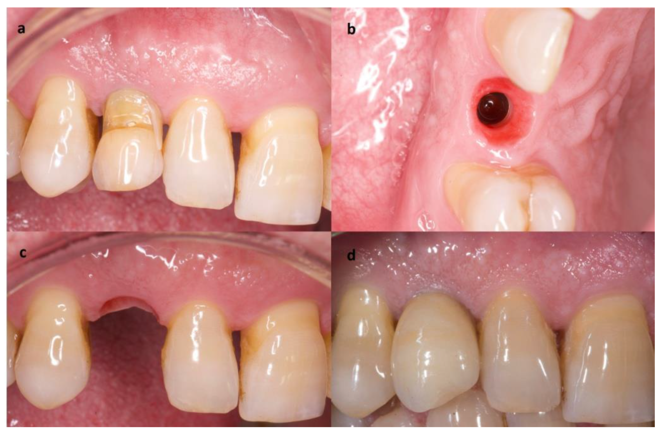 Materials 14 02757 g004