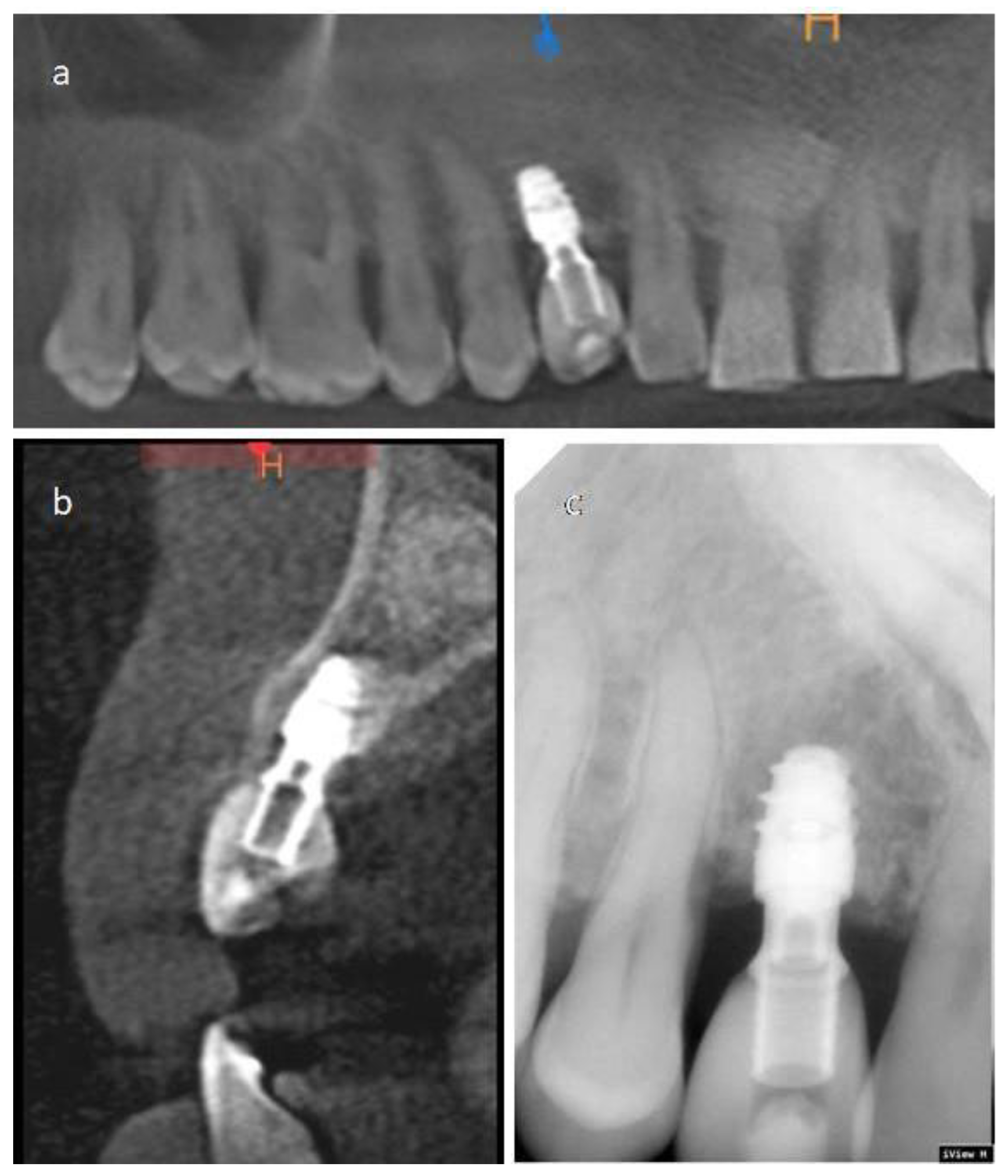 Materials 14 02757 g005