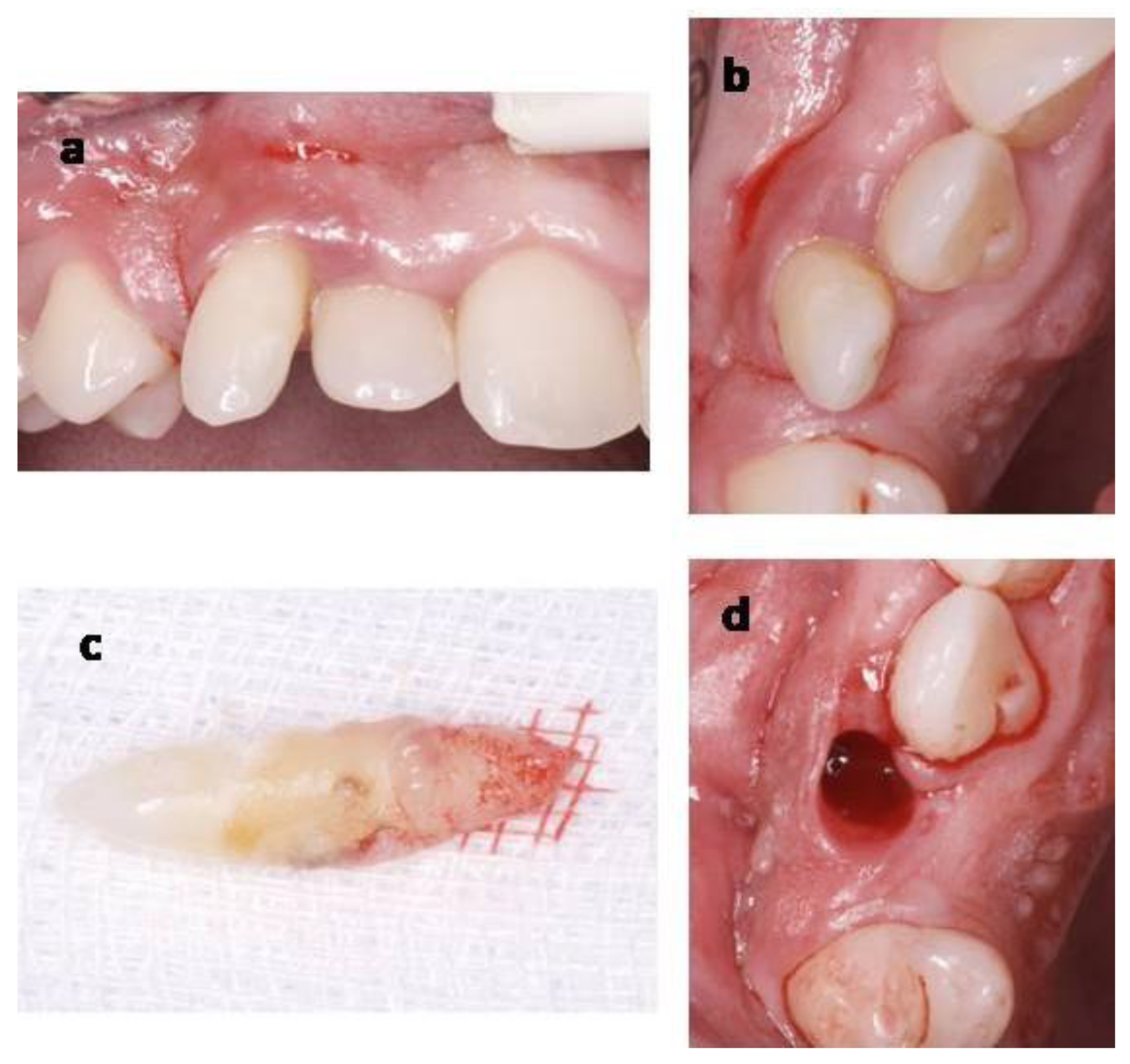 Materials 14 02757 g006