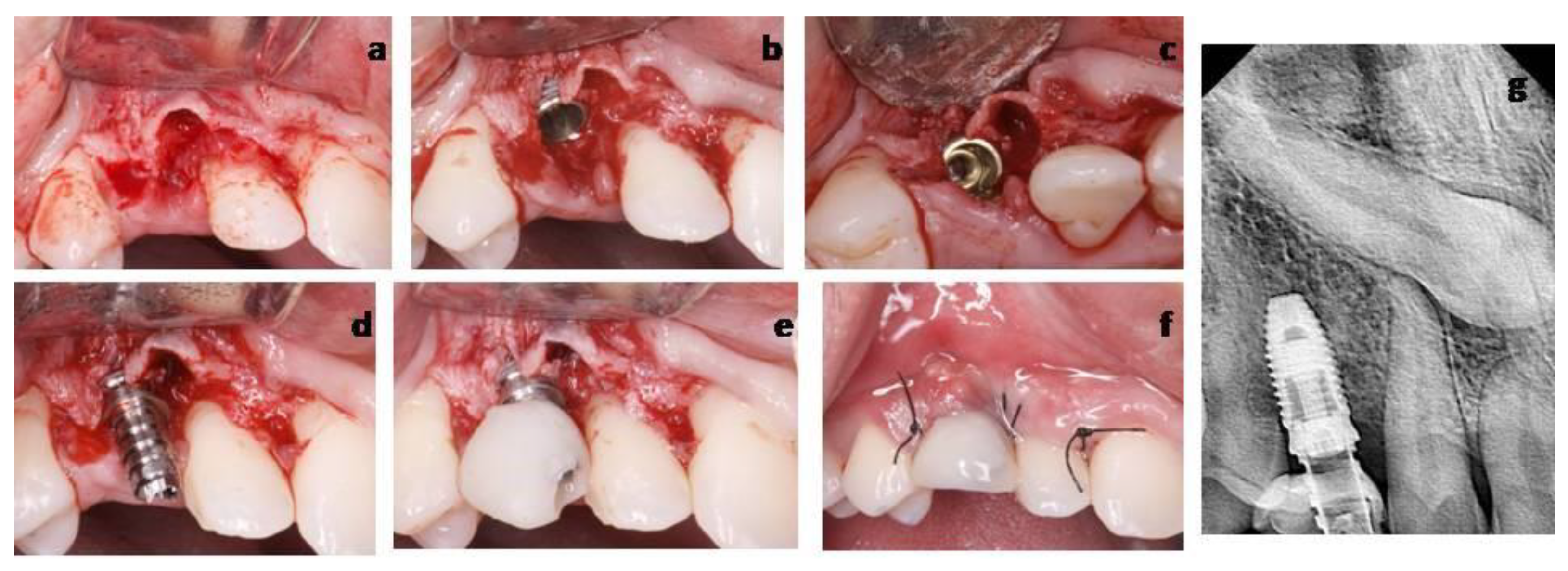 Materials 14 02757 g007