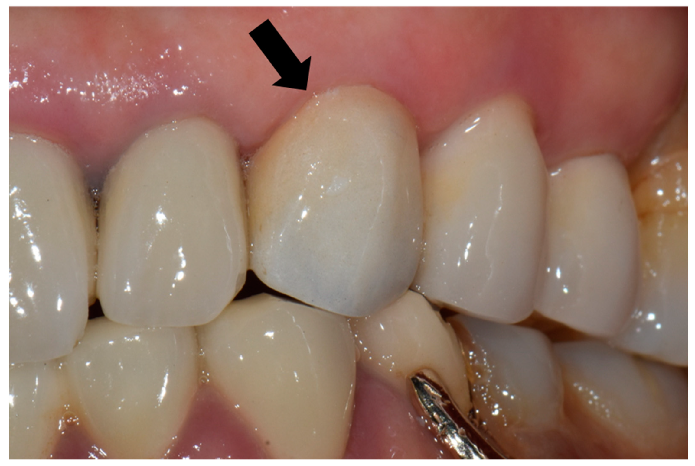 Materials 14 02762 g001 Materials 14 02762 g001