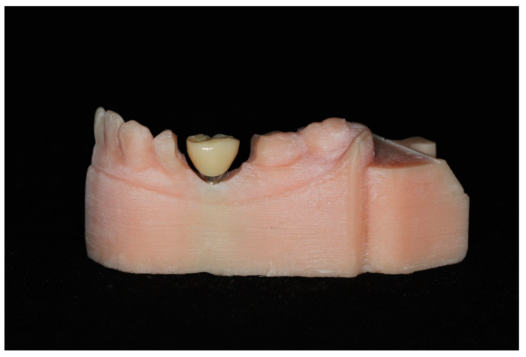 Materials 14 02843 g004