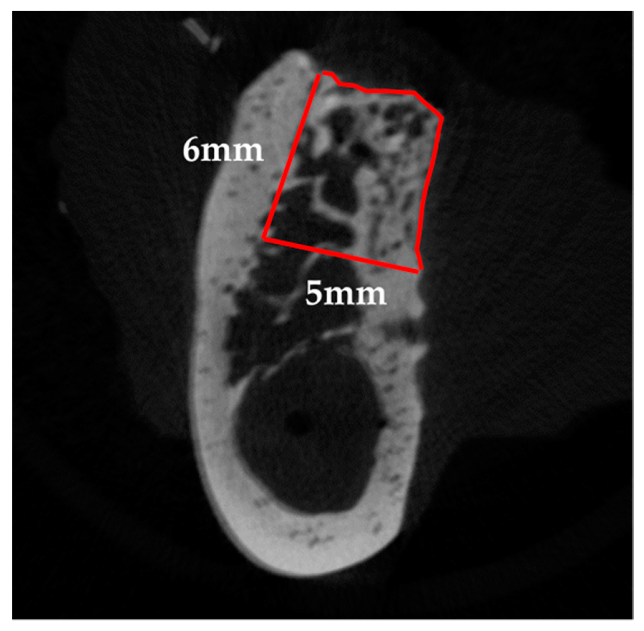 Materials 14 03358 g004 Materials 14 03358 g004