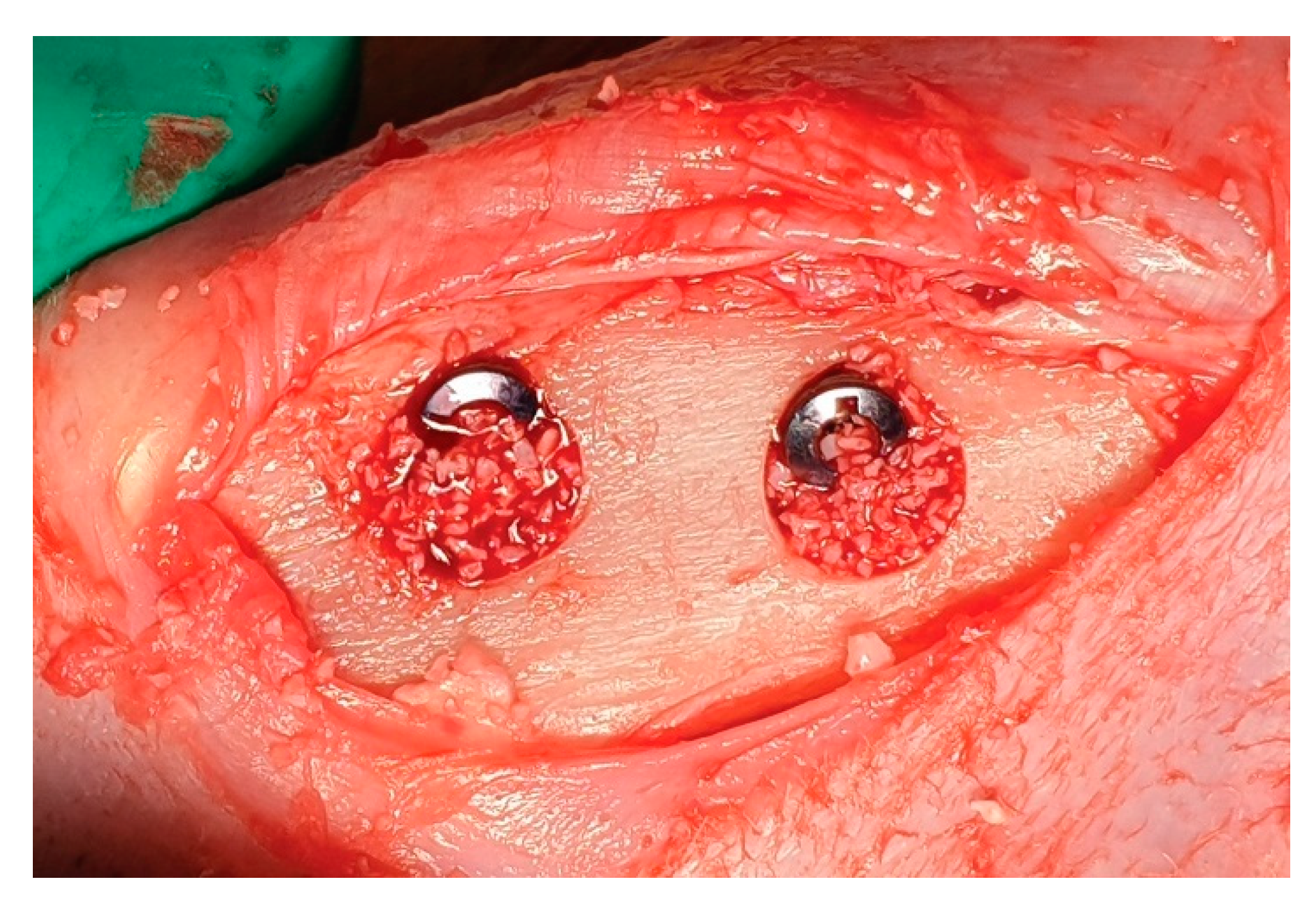 Materials 14 03707 g003