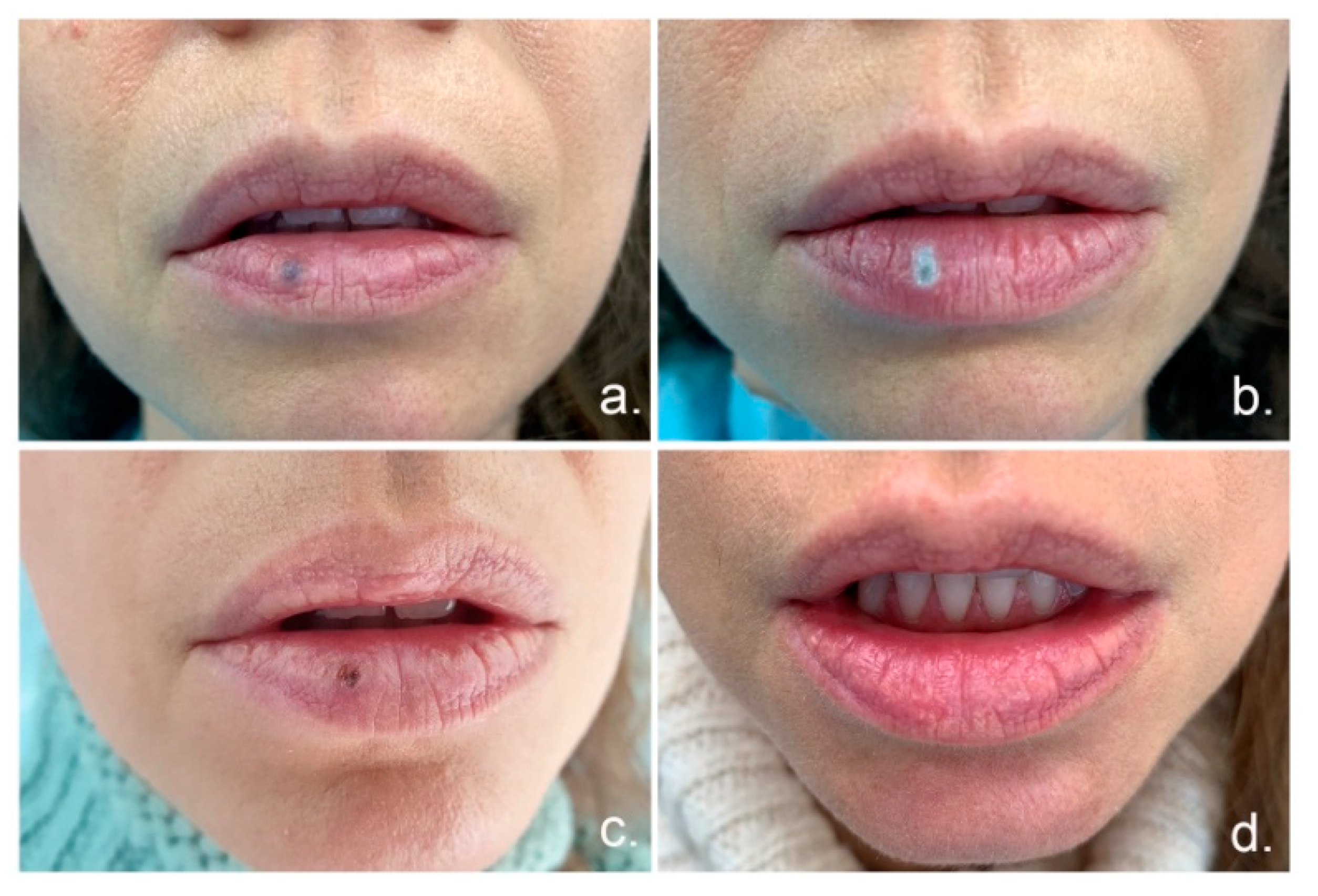 Materials 14 04140 g002