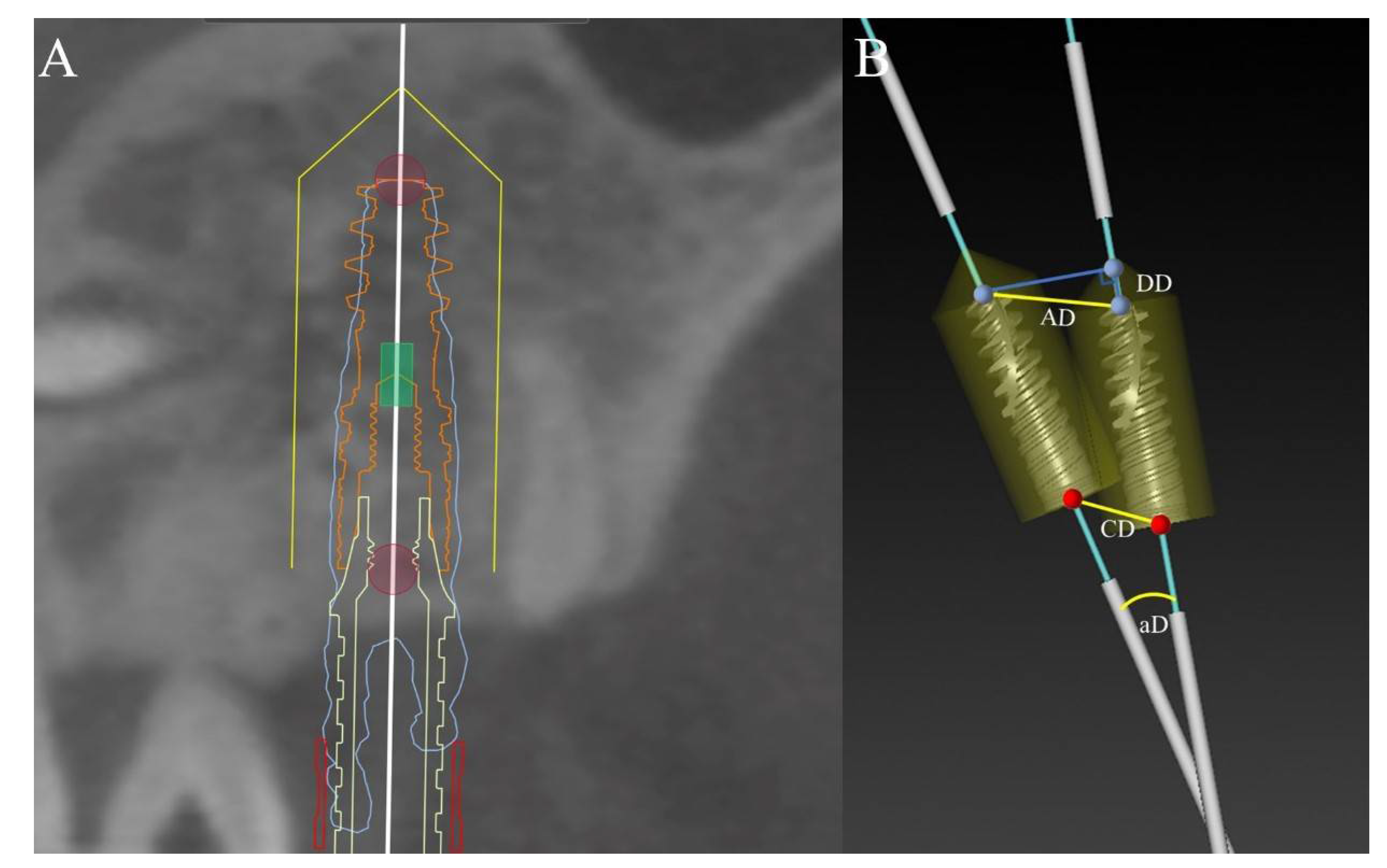 Materials 14 04631 g004