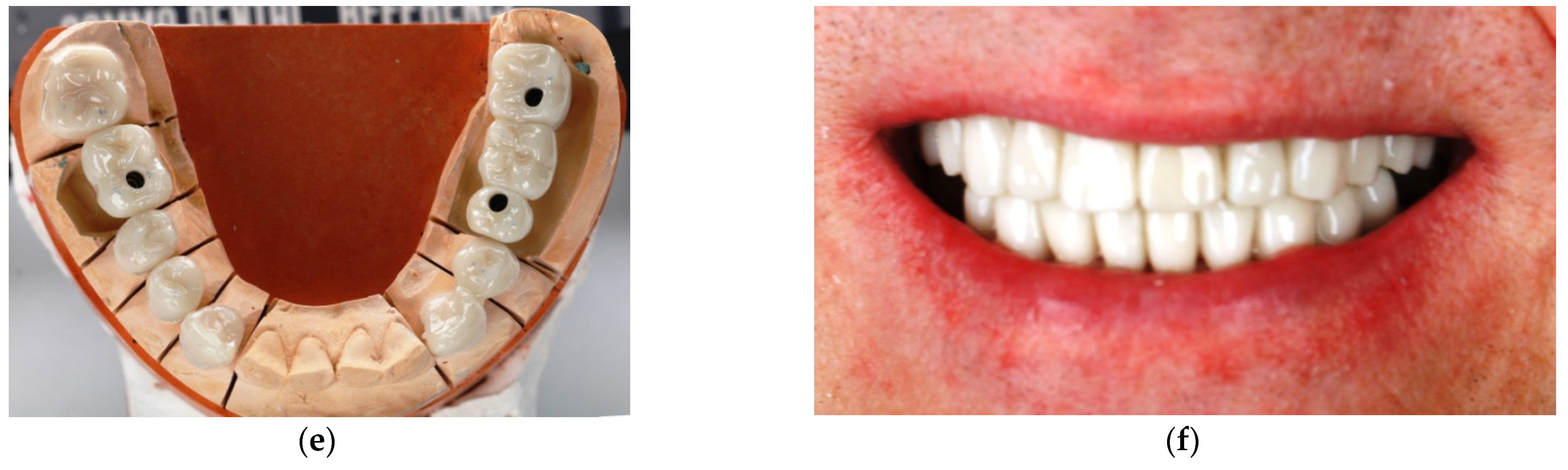 Materials 14 04678 g001b