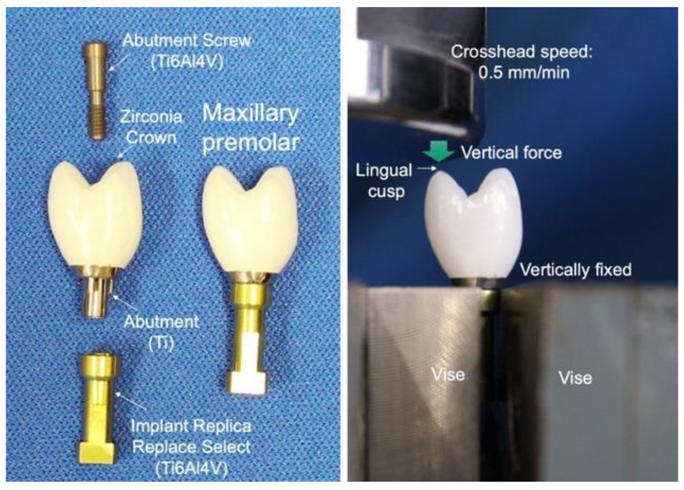 Materials 14 04879 g015