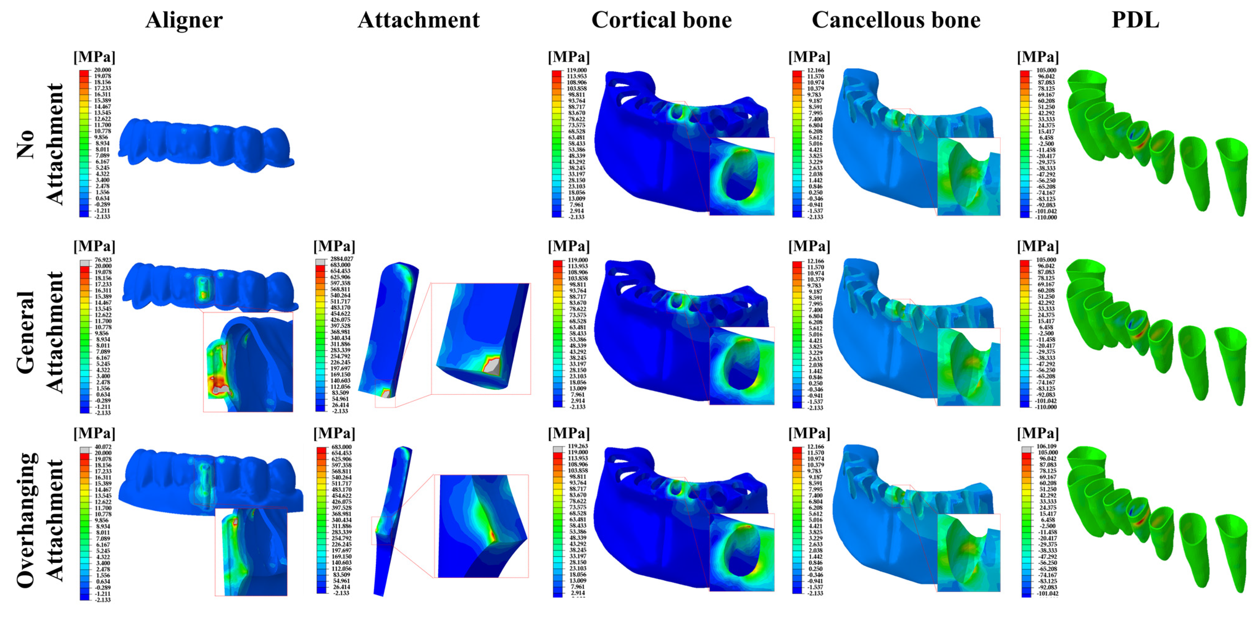Materials 14 04926 g005