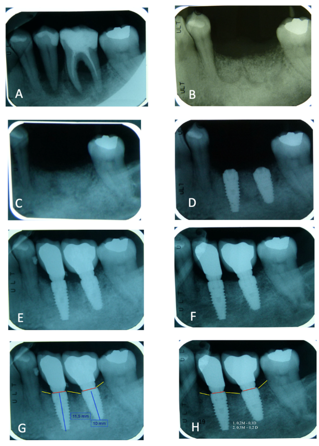 Materials 14 05292 g005