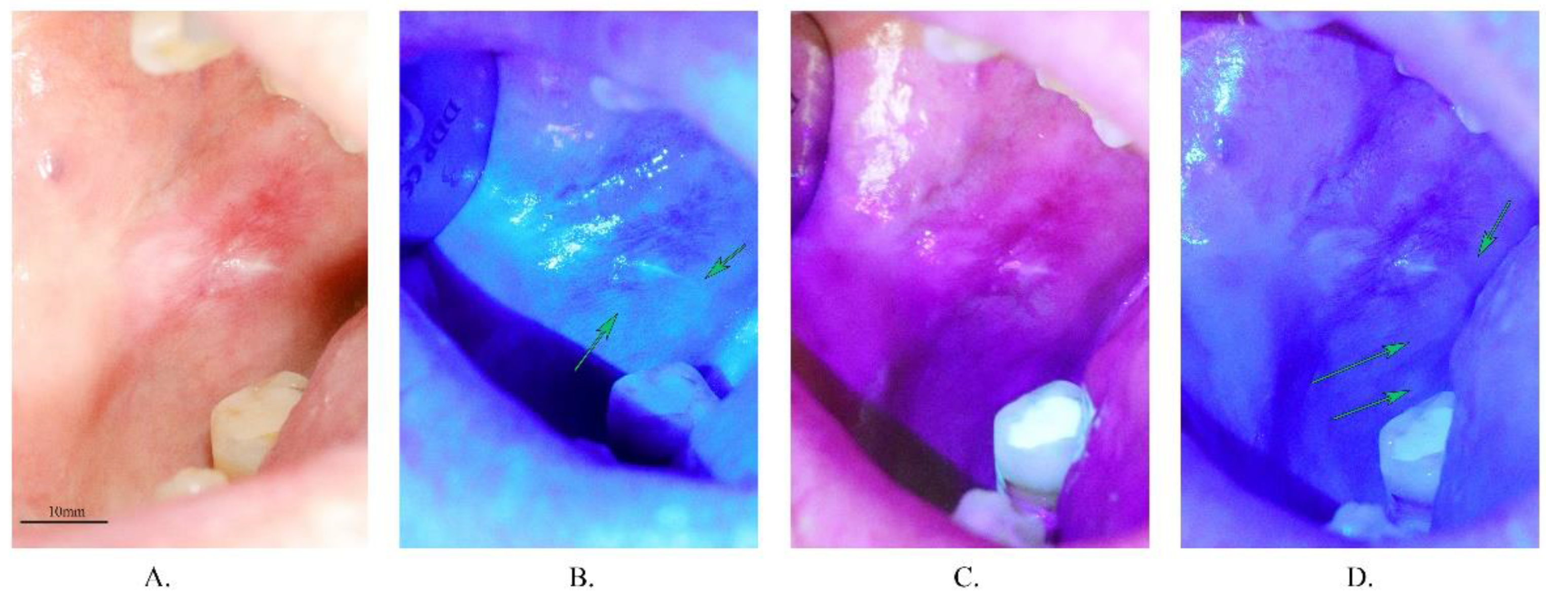 Materials 14 05448 g004