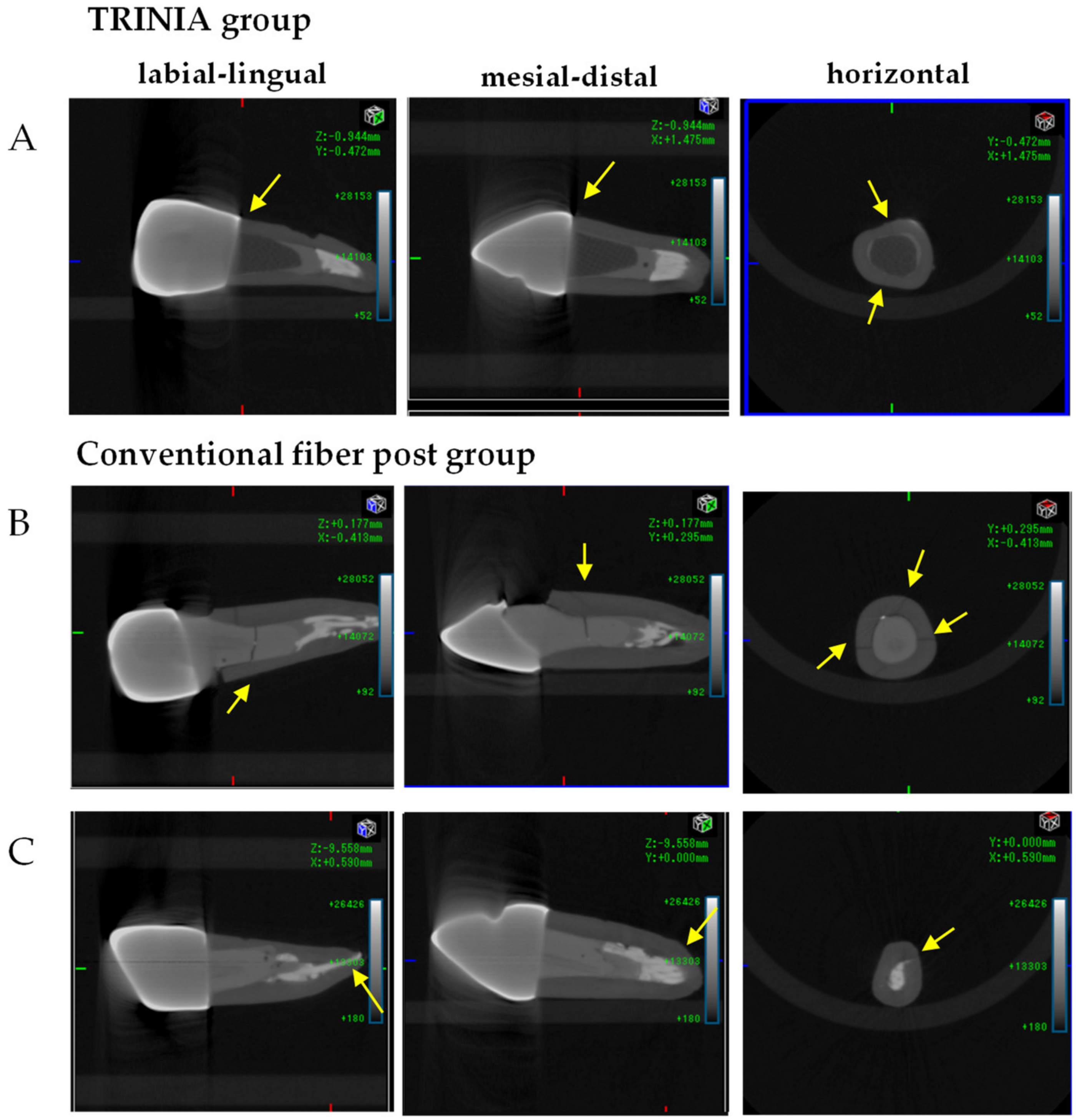 Materials 14 06199 g004