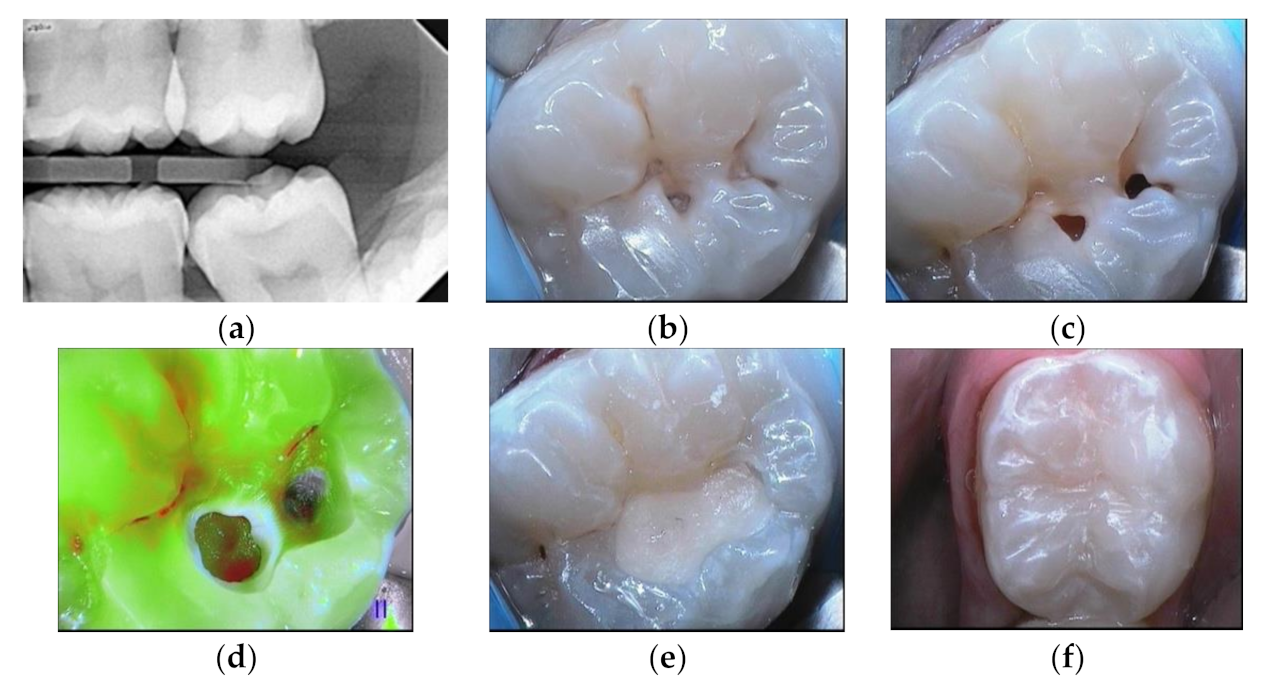 Materials 14 06272 g002