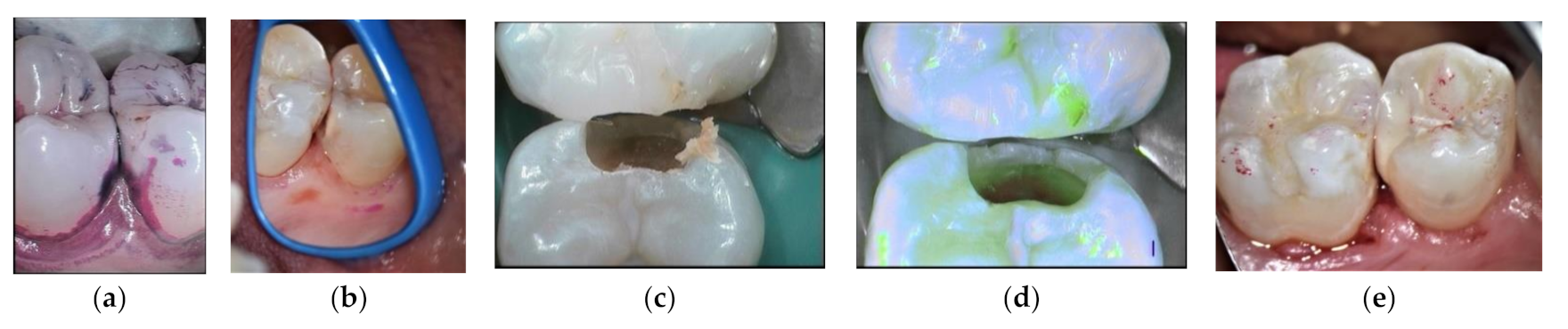 Materials 14 06272 g003