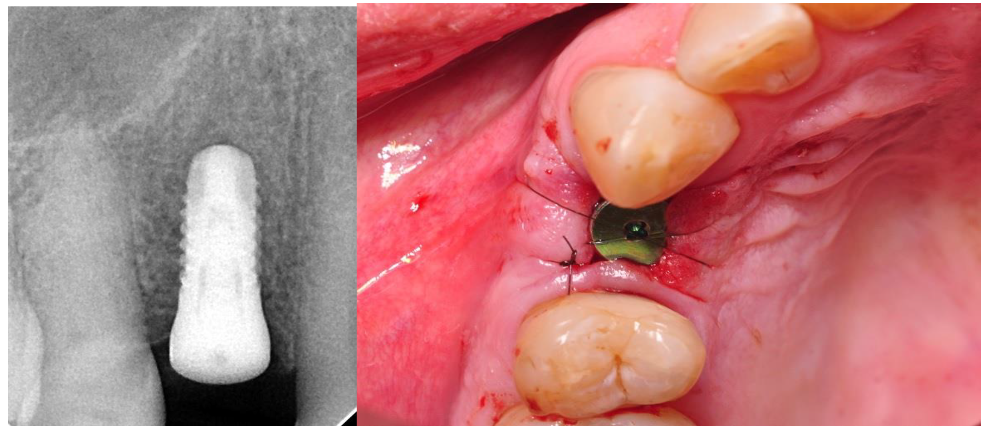 Materials 14 06353 g001