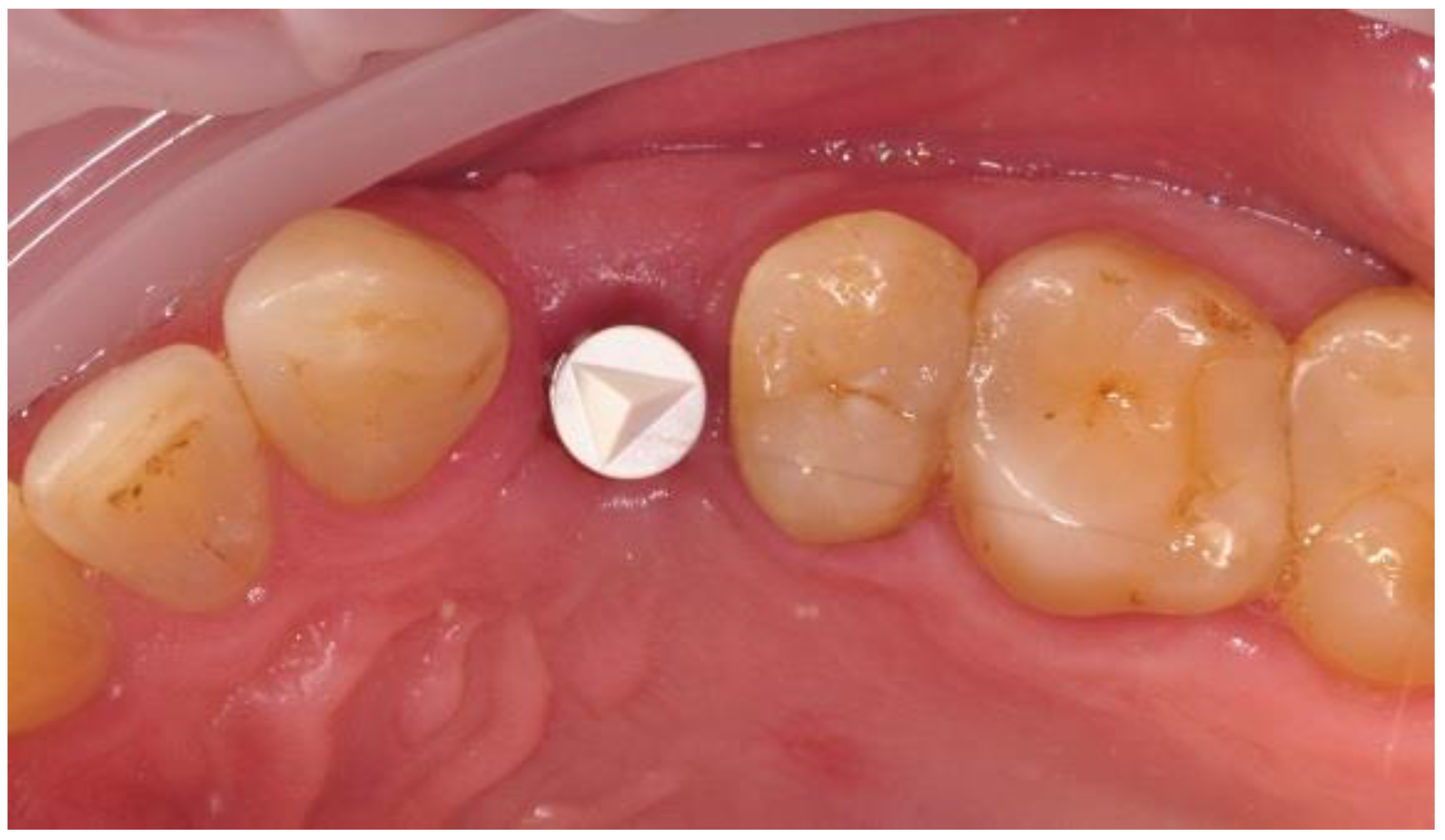 Materials 14 06353 g002