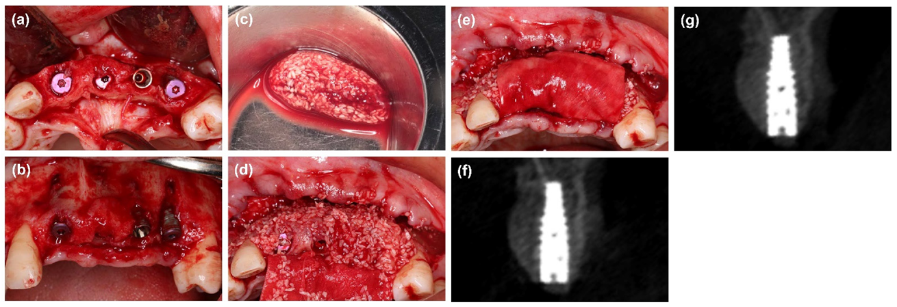 Materials 14 06430 g002