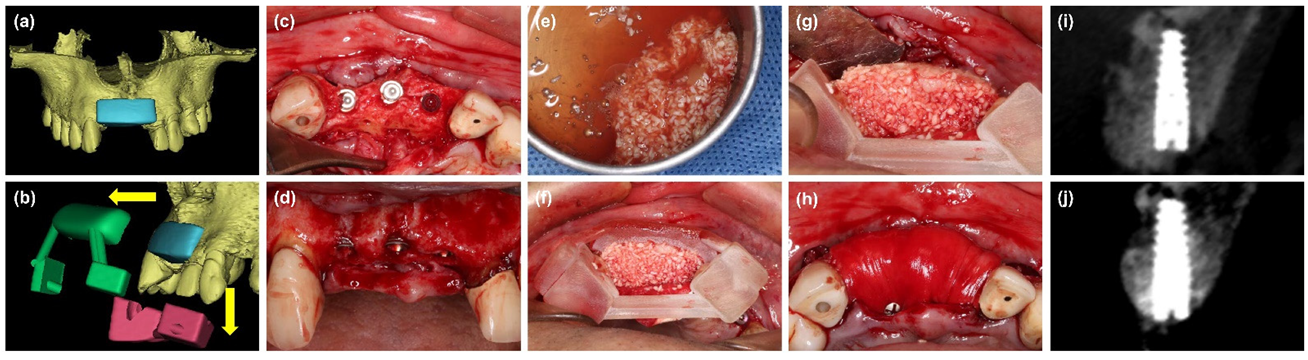 Materials 14 06430 g003