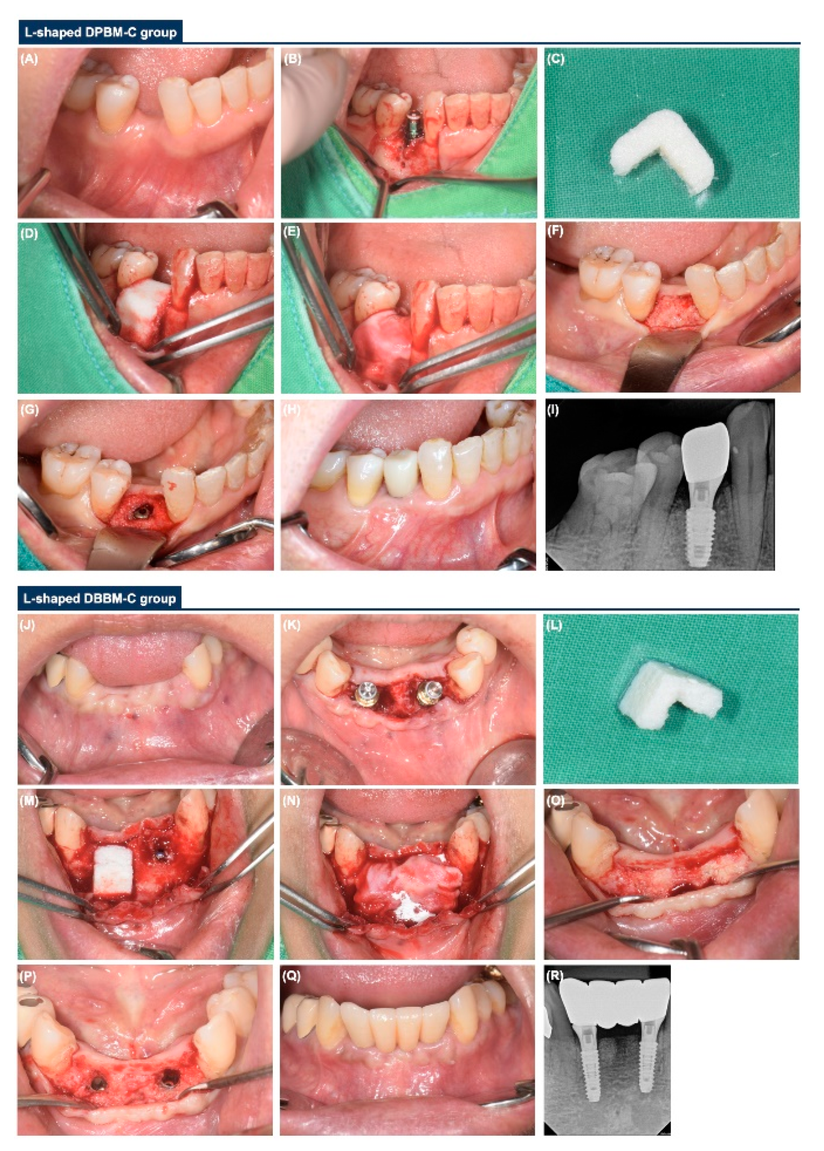 Materials 14 06580 g002