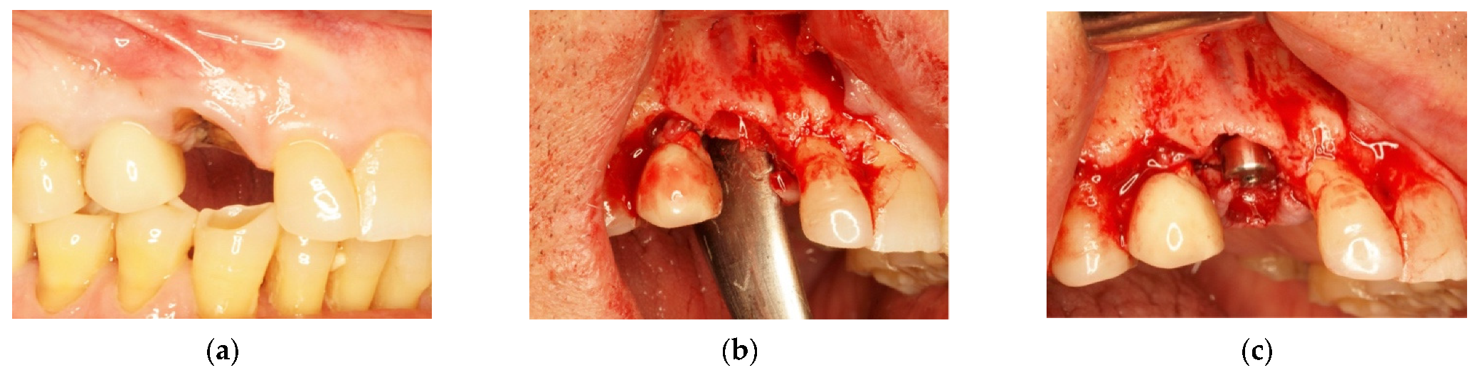 Materials 14 06642 g006 Materials 14 06642 g006