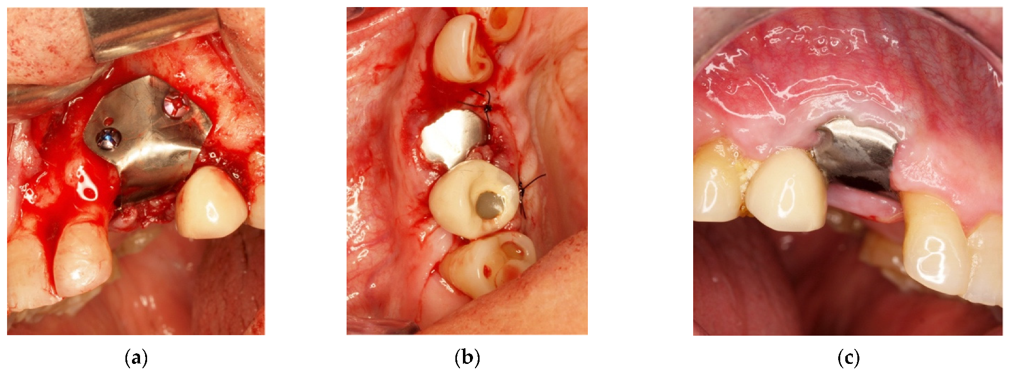 Materials 14 06642 g008 Materials 14 06642 g008