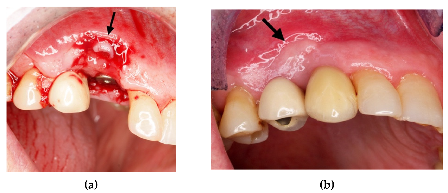 Materials 14 06642 g009 Materials 14 06642 g009
