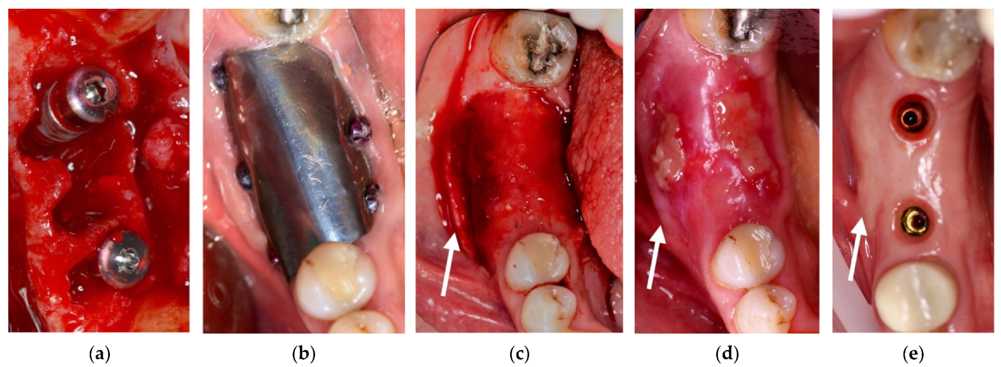 Materials 14 06642 g011 Materials 14 06642 g011