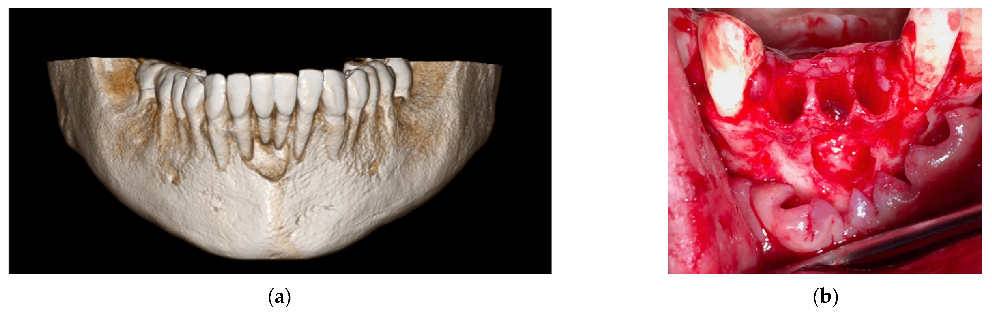 Materials 14 06642 g013 Materials 14 06642 g013