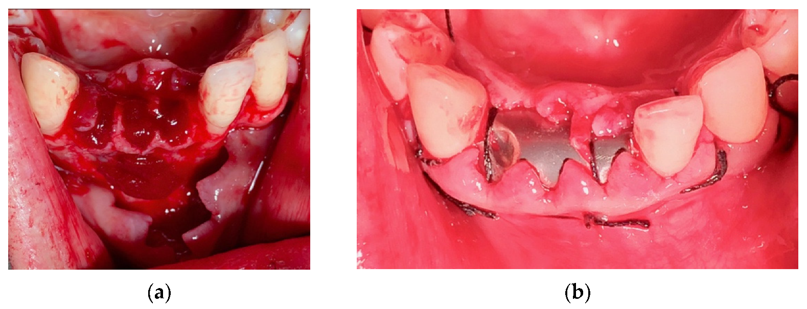 Materials 14 06642 g014 Materials 14 06642 g014