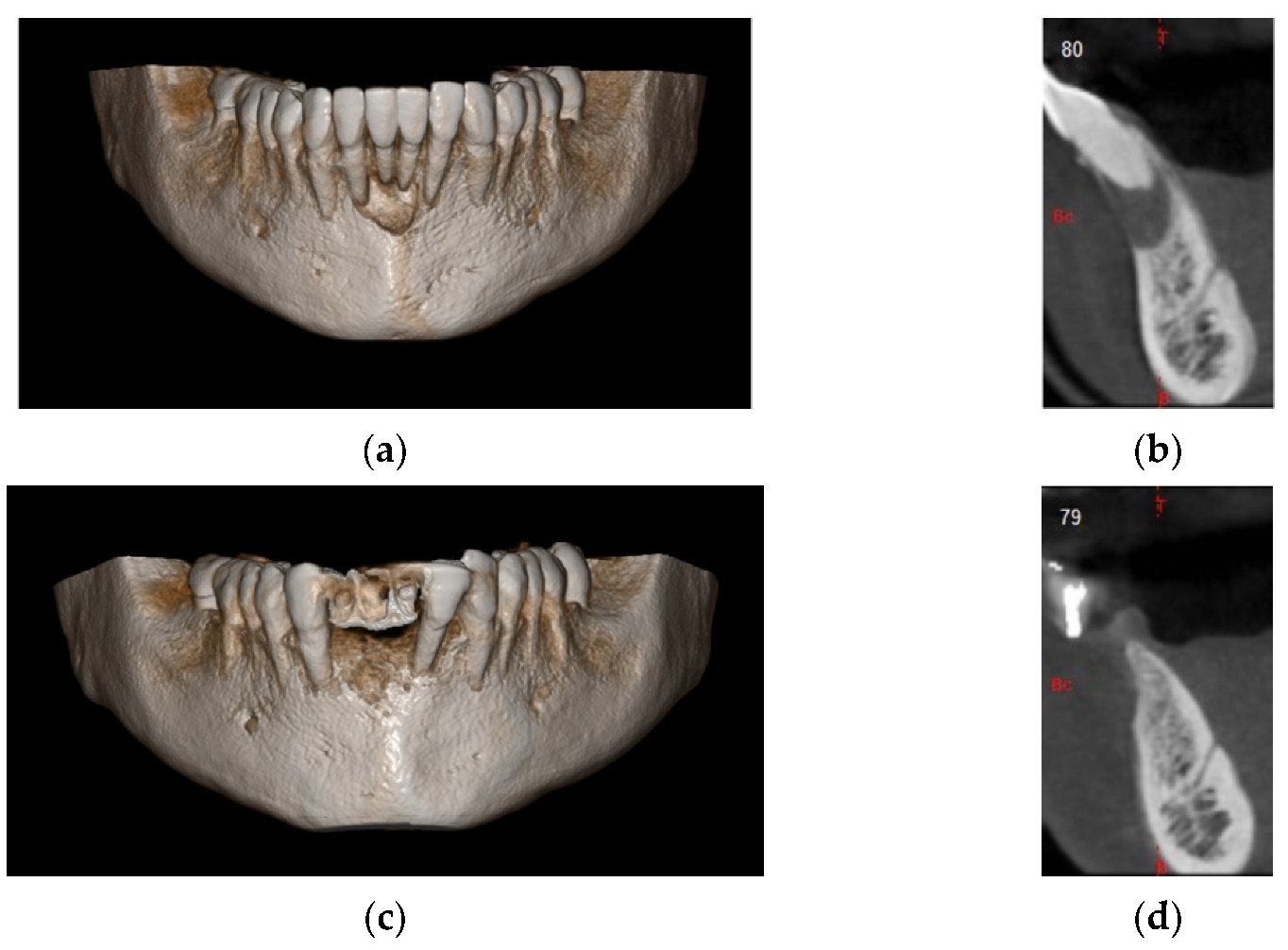Materials 14 06642 g017 Materials 14 06642 g017