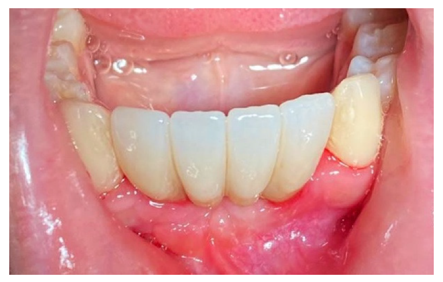 Materials 14 06642 g018 Materials 14 06642 g018