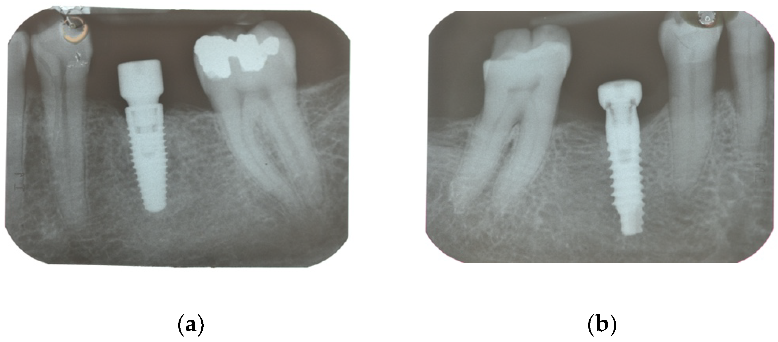 Materials 15 00511 g001