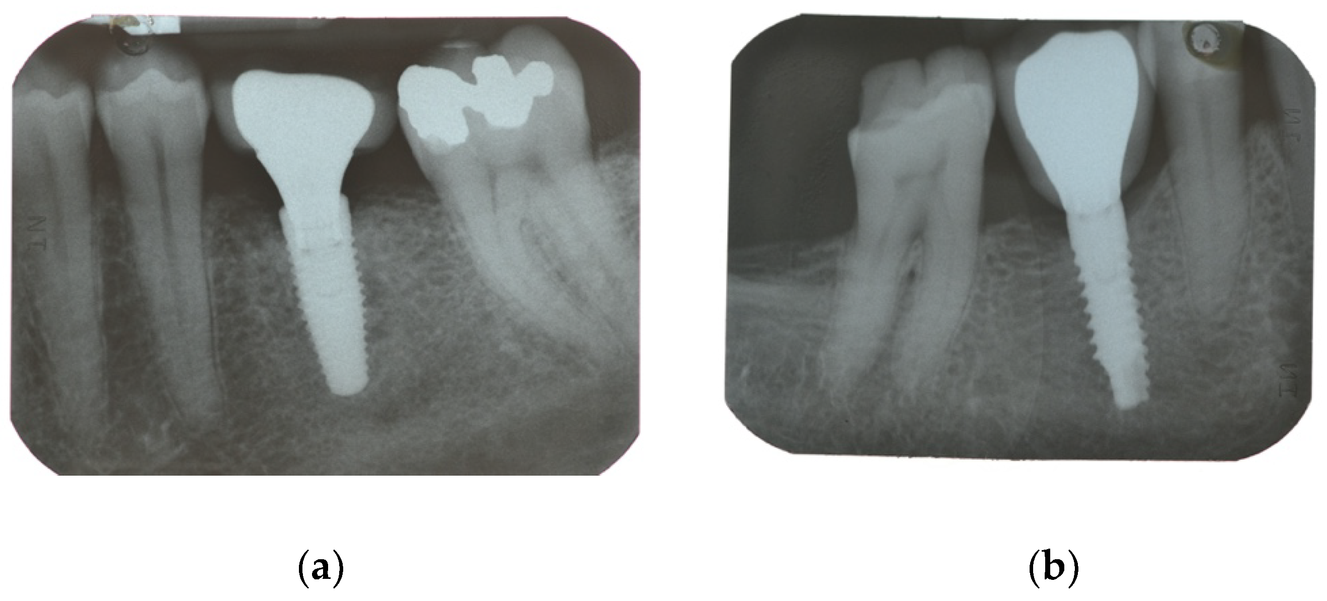 Materials 15 00511 g002