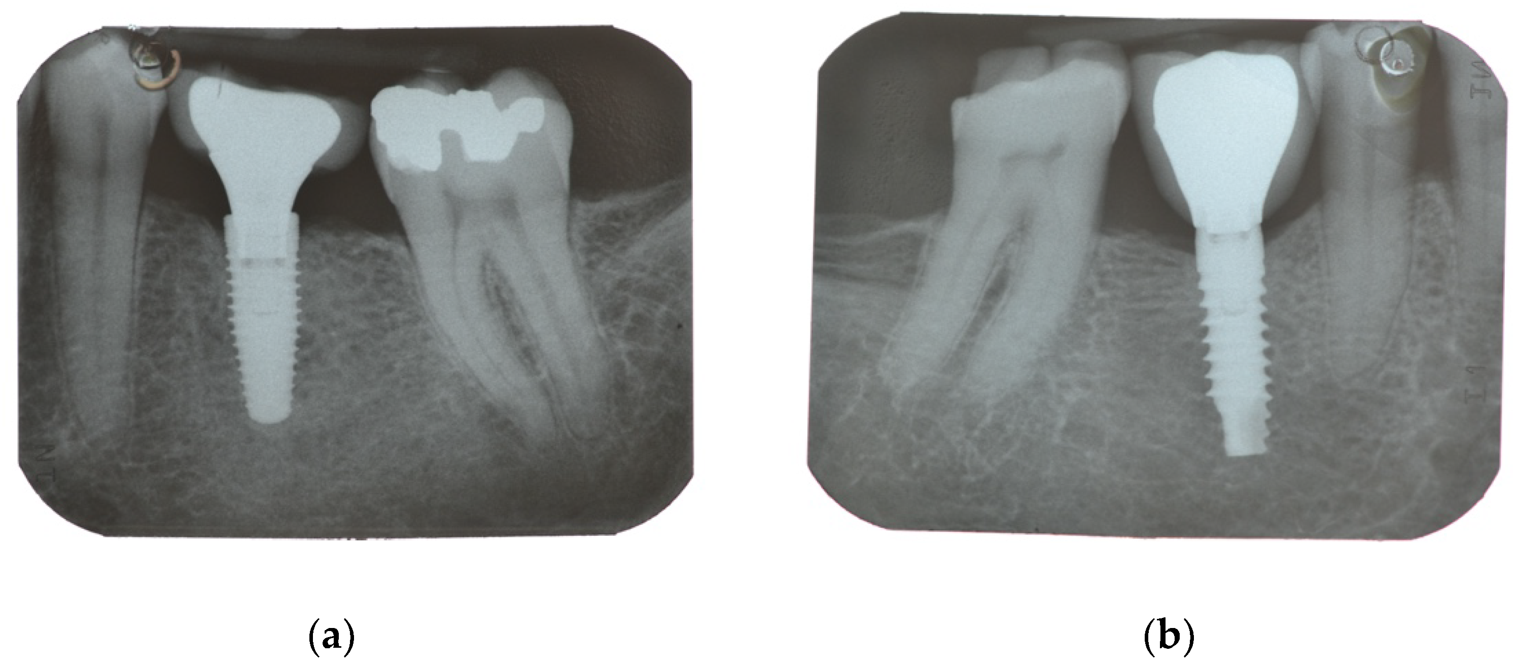 Materials 15 00511 g003