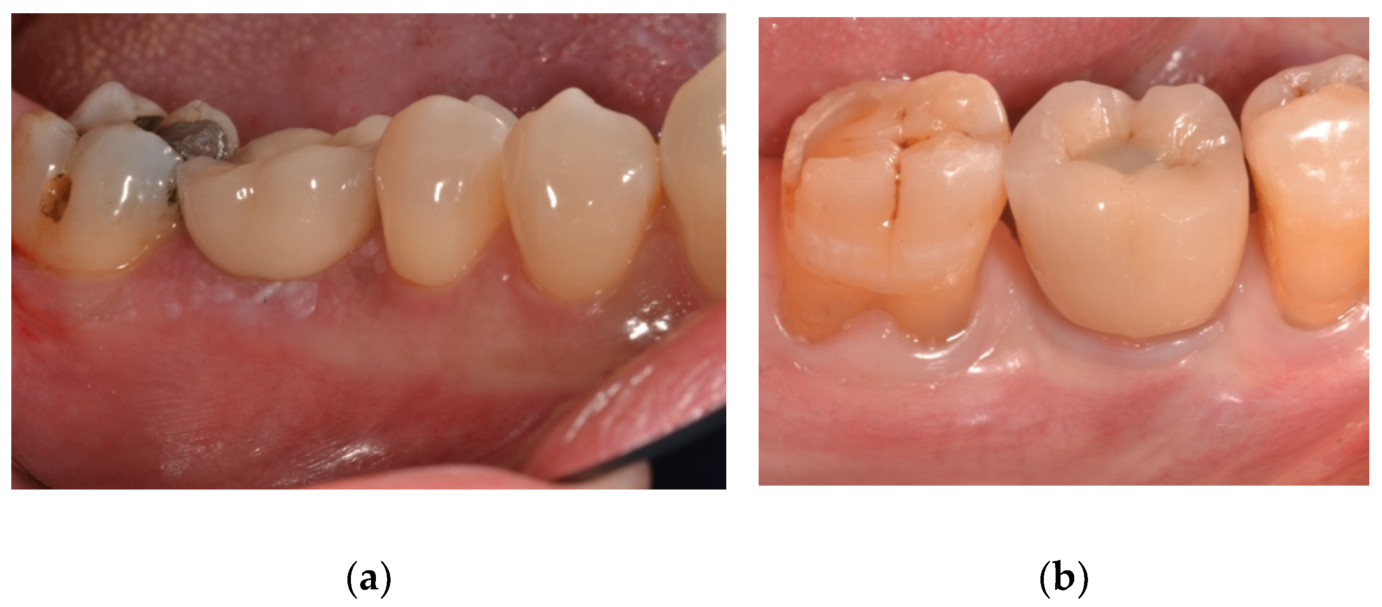 Materials 15 00511 g004