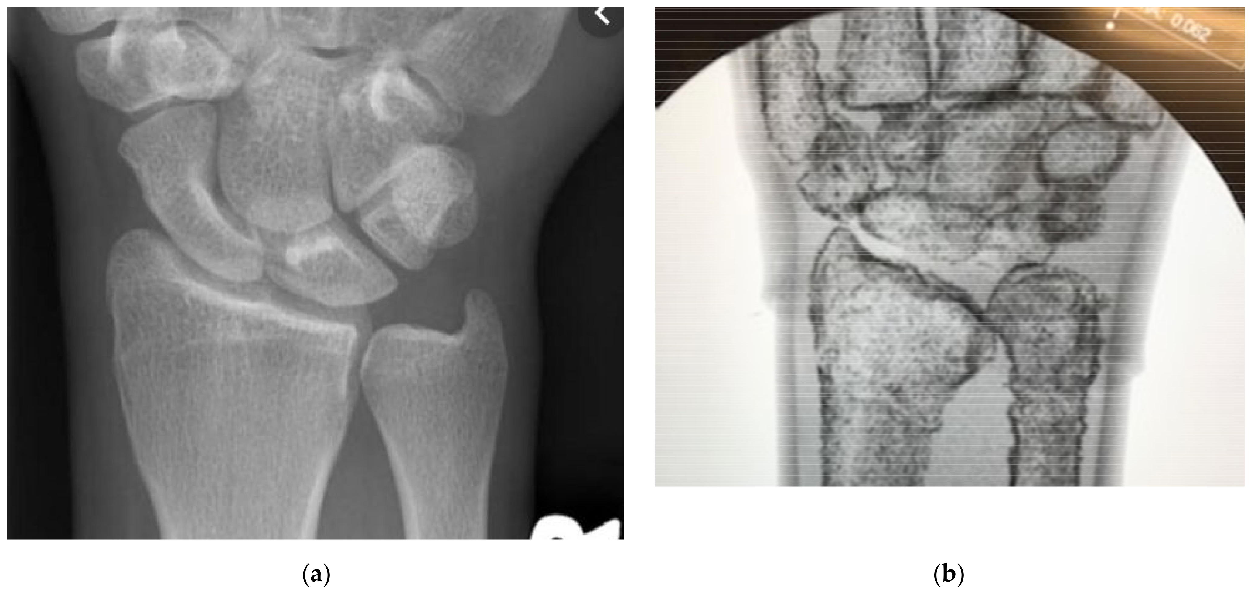 Materials 15 00694 g010