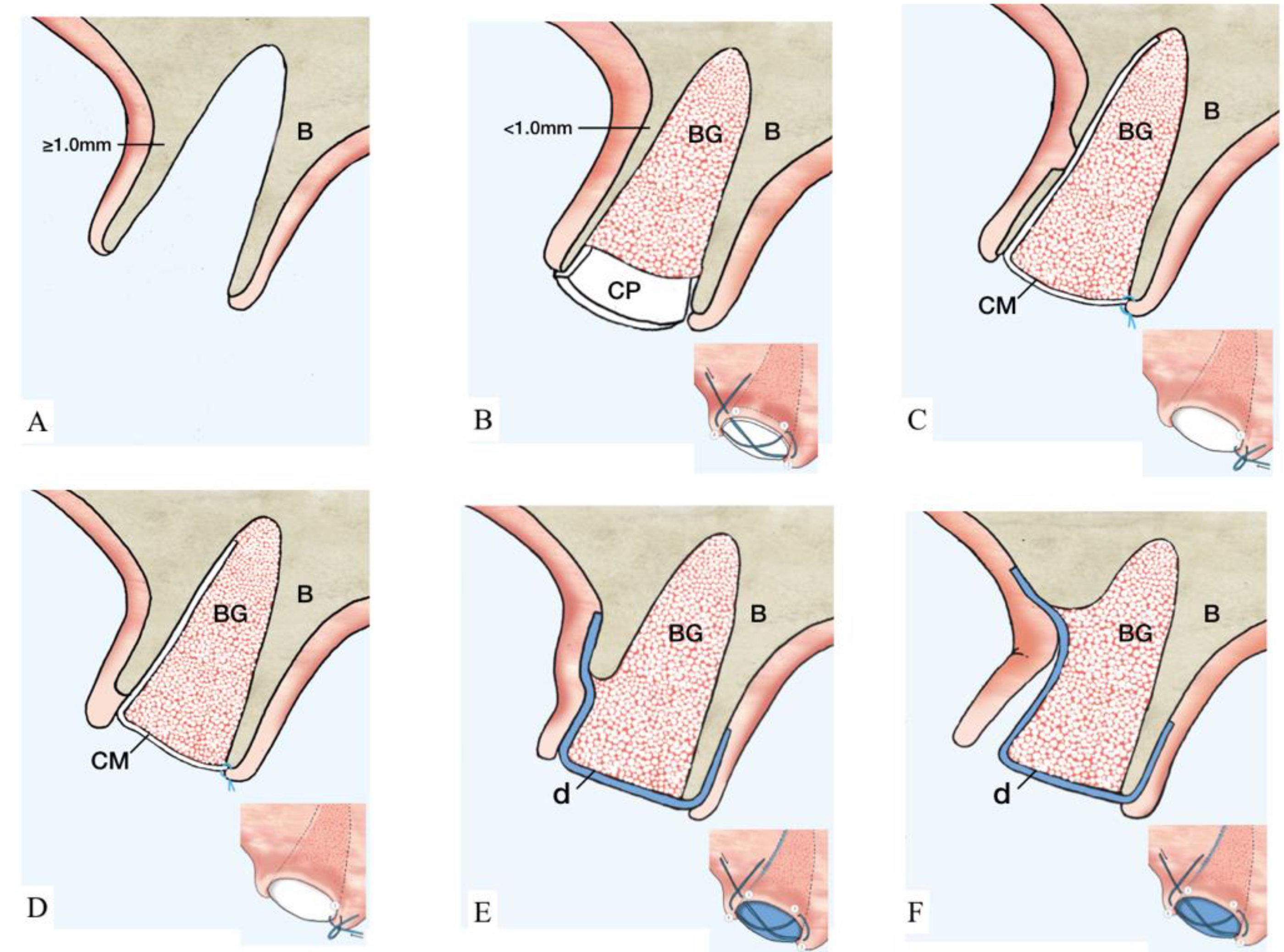 Materials 15 00733 g002