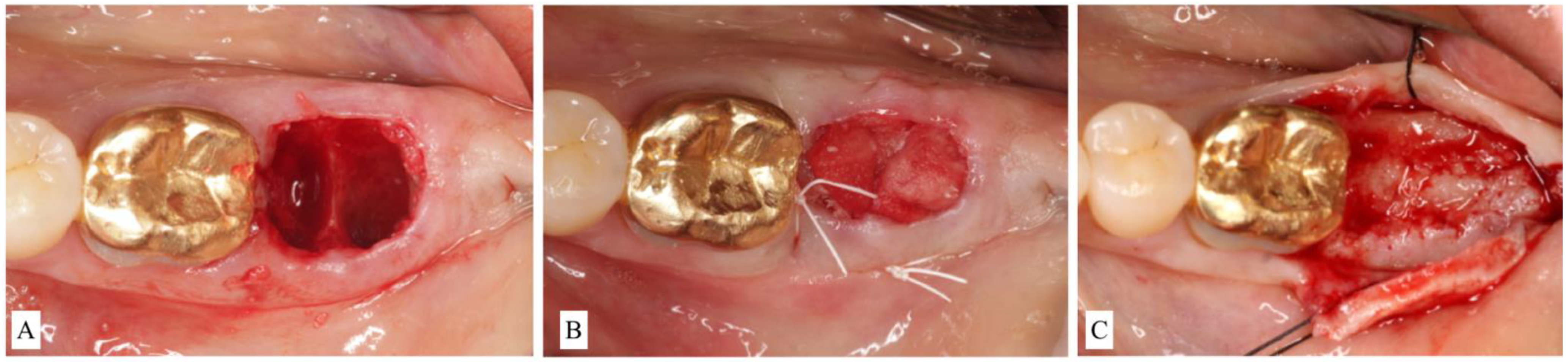 Materials 15 00733 g003